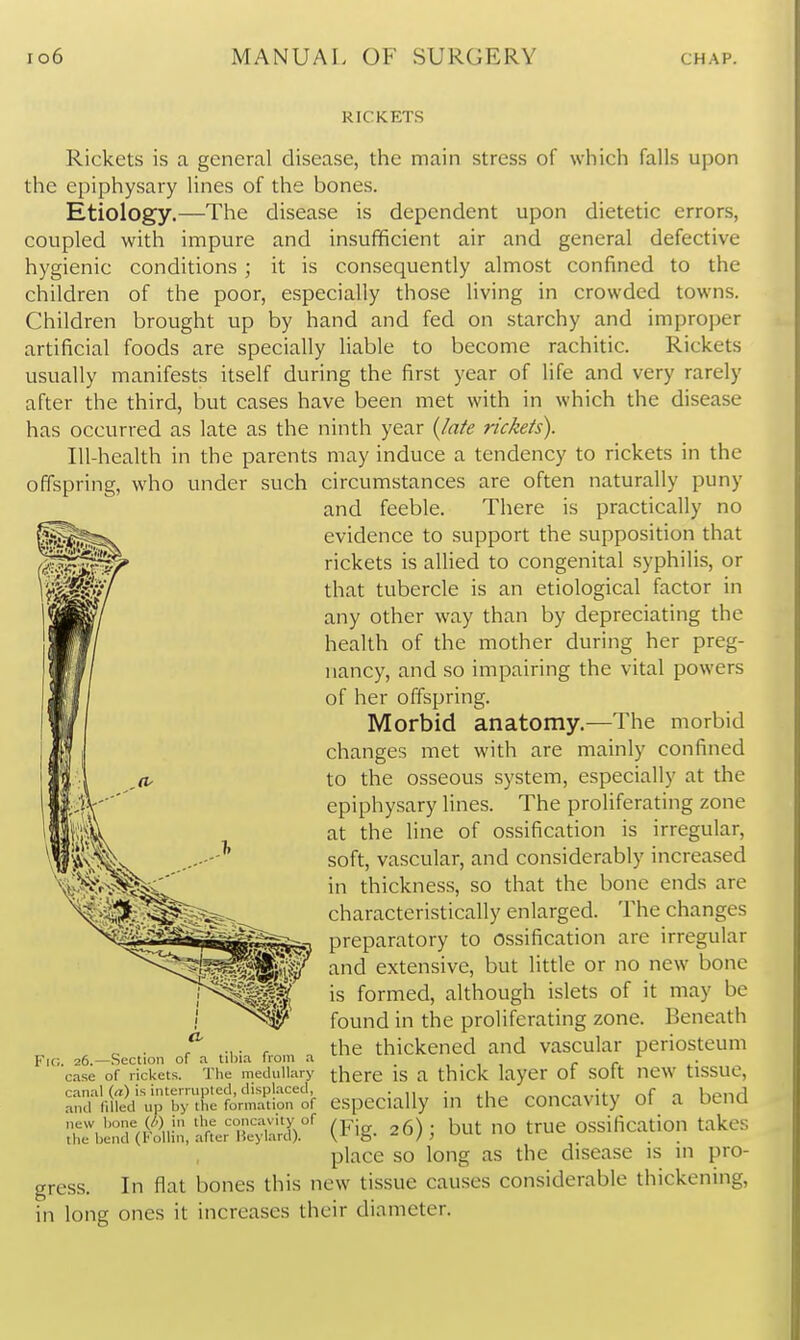 RICKETS Rickets is a general disease, the main stress of which falls upon the epiphysary lines of the bones. Etiology.—The disease is dependent upon dietetic errors, coupled with impure and insufficient air and general defective hygienic conditions ; it is consequently almost confined to the children of the poor, especially those living in crowded towns. Children brought up by hand and fed on starchy and improper artificial foods are specially liable to become rachitic. Rickets usually manifests itself during the first year of life and very rarely after the third, but cases have been met with in which the disease has occurred as late as the ninth year {late rickets). Ill-health in the parents may induce a tendency to rickets in the offspring, who under such circumstances are often naturally puny and feeble. There is practically no evidence to support the supposition that rickets is allied to congenital syphilis, or that tubercle is an etiological factor in any other way than by depreciating the health of the mother during her preg- nancy, and so impairing the vital powers of her offspring. Morbid anatomy.—The morbid changes met with are mainly confined to the osseous system, especially at the epiphysary lines. The proliferating zone at the line of ossification is irregular, soft, vascular, and considerably increased in thickness, so that the bone ends are characteristically enlarged. The changes preparatory to ossification are irregular and extensive, but little or no new bone is formed, although islets of it may be found in the proliferating zone. Beneath the thickened and vascular periosteum there is a thick layer of soft new tissue, yhrfo;mTtionof especially in the concavity of a bend rbS^iial^ri^lX' (Fig- 26); but no true ossification takes place so long as the disease is in pro- In flat bones this new tissue causes considerable thickening, Fig. 26.—.Section of a tibia from a case of rickets. The medullary canal {a) is interrupted, displaced and filled up ' in long ones it increases their diameter.