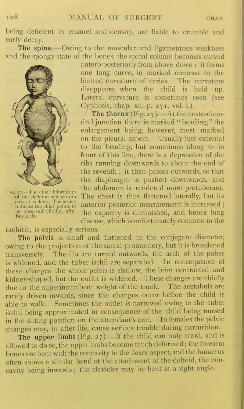 being deficient in enamel and density, arc liable to crumble and early decay. The spine.—Owing to the muscular and ligamentous weakness and the spongy state of the bones, the spinal column becomes curved antero-posteriorly from above down ; it forms one long curve, in marked contrast to the limited curvature of caries. The curvature disappears when the child is held up. Lateral curvature is sometimes seen (see Cyphosis, chap. xii. p. 271, vol. i.). The thorax (Fig. 27).—At the costo-chon- dral junction there is marked  beading, the enlargement being, however, most marked on the pleural aspect. Usually just external to the beading, but sometimes along or in front of this line, there is a depression of the ribs running downwards to about the end of the seventh ; it then passes outwards, so that the diaphragm is pushed downwards, and the abdomen is rendered more protuberant. The chest is thus flattened laterally, but its anterior posterior measurement is increased ; the capacity is diminished, and hence lung disease, which is unfortunately common in the rachitic, is especially serious. The pelvis is small and flattened in the conjugate diameter, owing to the projection of the sacral promontory, but it is broadened transversely. The ilia are turned outwards, the arch of the pubes is widened, and the tuber ischii are separated. In consequence of these changes the whole pelvis is shallow, the brim contracted and kidney-shaped, but the outlet is widened. These changes are chiefly due to the superincumbent weight of the trunk. The acetabula are rarely driven inwards, since the changes occur before the child is able to walk. Sometimes the outlet is narrowed owing to the tuber ischii being approximated in consequence of the child being nursed in the sitting position on the attendant's arm. In females the pelvic changes may, in after life, cause serious trouble during parturition. The upper limbs (Fig. 27).—If the child can only crawl, and is allowed to do so, the upper limbs become much deformed; the forearm bones are bent with the concavity to the flexor aspect, and the humerus often shows a similar bend at the attachment of the deltoid, the con- cavity being inwards ; the clavicles may be bent at a right angle. Fig. 27.—The chief deformities of the skeleton met with in cases of rickets. The letters indicate the chief points to be observed (Follin, after Beylard).