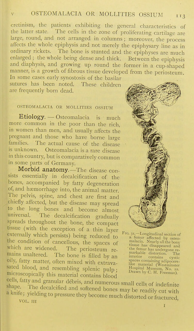 OSTEOMALACIA OR MOLLITIES OSSIUM if3 cretinism, the patients exhibiting the general characteristics of the latter state. The cells in the zone of proliferating cartilage are large, round, and not arranged in columns ; moreover, the process affects the whole epiphysis and not merely the epiphysary line as in ordinary rickets. The bone is stunted and the epiphyses are much enlarged ; the whole being dense and thick. Between the epiphysis and diaphysis, and growing up round the former in a cup-shaped manner, is a growth of fibrous tissue developed from the periosteum. In some cases early synostosis of the basilar sutures has been noted. These children are frequently born dead. OSTEOMALACIA OR MOLLITIES OSSIUM Etiology. — Osteomalacia is much more common in the poor than the rich, in women than men, and usually affects the pregnant and those who have borne large families. The actual cause of the disease is unknown. Osteomalacia is a rare disease in this country, but is comparatively common in some parts of Germany. Morbid anatomy.—The disease con- sists essentially in decalcification of the bones, accompanied by fatty degeneration of, and haemorrhage into, the animal matter. The pelvis, spine, and chest are first and chiefly affected, but the disease may spread to the long bones and become almost universal. The decalcification gradually spreads throughout the bone, the compact tissue (with the exception of a thin layer externally which persists) being reduced to the condition of cancellous, the spaces of which are widened. The periosteum re- mains unaltered. The bone is filled by an oily, fatty matter, often mixed with extrava- sated blood, and resembling splenic pulp; microscopically this material contains blood S'e^''Thf/'? ^'-^'■•^ -^^^-^^l ^definite Shape I he decalcified and softened bones may be readily cut with a knife; y.eldmg to pressure they become much distorted or Lactured VOL. Ill ' Fig. 31.—Longitudinal section of a femur aflFected by osteo- malacia. Nearly all the bony tissue has disappeared and the femur has undergone re- ni.arl<able distortion. The interior contains cystic spaces containing adipocere- like material (Westminster Hospital Museum, No. 22. Drawn by C. H. Freeman).