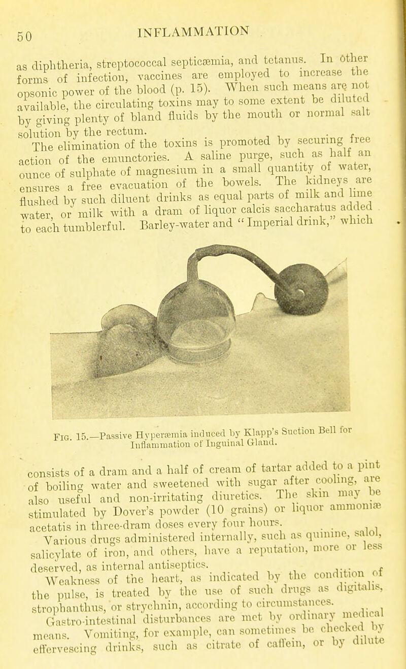 as diphtheria, streptococcal septicaemia, and tetanus. In Other forms of infection, vaccines are employed to increase the opsonic power of the blood (p. 15). When such means arQ no available, the circulating toxins may to some extent be diluted by giving plenty of bland fluids by the mouth or normal salt solution by the rectum. • r „ The elimination of the toxins is promoted by securing free action of the emunctories. A saline purge, such as ha f an ounce of sulphate of magnesium m a small quantity of watei, ensures a ftee evacuation of the bowels. The kidneys are flushed by such diluent drinks as equal parts of milk and lime water, or milk with a dram of liquor calcis saccharatus added to each tumblerful. Barley-water and  Imperial drink,' which Fig 15.-Passive Hvperamia induced by Klapp's Suction Bell for Inflammation of Inguinal Gland. consists of a dram and a half of cream of tartar added to a pint of boilincT xvater and sweetened with sugar after cooling, are also useful and non-irritating diuretics. The skin may be stimulated by Dover's powder (10 grains) or liquor ammoniae. acetatis in three-dram doses every four hours Various drugs administered internally, such as qunune, salol, salicylate of iron, and others, have a reputation, more or less deserved, as internal antiseptics. Weakness of the heart, as indicated by the condition of the pulse, is treated by the use of such drugs as digitalis, strophanthus, or strychnin, according to cirenmst^mces Gastro-intestinal disturbances are met by ordinary medical means. Vomiting, for example, can sonietiines bo checked by effervescing drinks, such as citrate of caffein, or by dilute