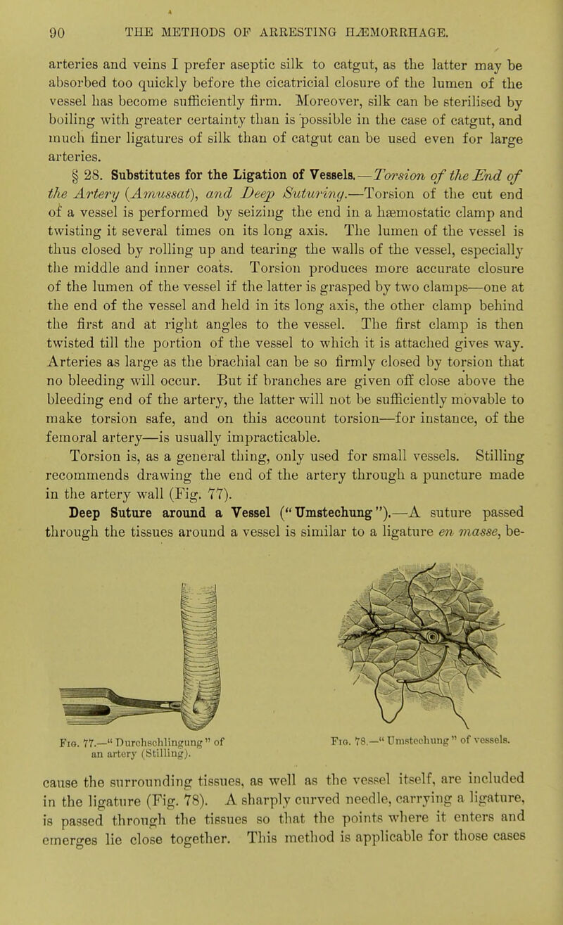 4 arteries and veins I prefer aseptic silk to catgut, as the latter may be absorbed too quickly before the cicatricial closure of the lumen of the vessel has become sufficiently firm. Moreover, silk can be sterilised by boiling with greater certainty than is possible in the case of catgut, and much finer ligatures of silk than of catgut can be used even for large arteries. § 28. Substitutes for the Ligation of Vessels.—Torsion of the End of the Artery {A?n'ussat), and Deep Suturing.—Torsion of the cut end of a vessel is performed by seizing the end in a haemostatic clamp and twisting it several times on its long axis. The lumen of the vessel is thus closed by rolling up and tearing the walls of the vessel, especially the middle and inner coats. Torsion produces more accurate closure of the lumen of the vessel if the latter is grasped by two clamps—one at the end of the vessel and held in its long axis, the other clamp behind the first and at right angles to the vessel. The first clamp is then twisted till the portion of the vessel to which it is attached gives way. Arteries as large as the brachial can be so firmly closed by torsion that no bleeding will occur. But if branches are given off close above the bleeding end of the artery, tlie latter will not be sufiiciently movable to make torsion safe, and on this account torsion—for instance, of the femoral artery—is usually impracticable. Torsion is, as a general thing, only used for small vessels. Stilling recommends drawing the end of the artery through a puncture made in the artery wall (Fig. T7). Deep Suture around a Vessel ( TJmstechung).—A suture passed through the tissues around a vessel is similar to a ligature en masse, be- Fio. 77.— Durchschlingung  of Fio. 78.— Dnistechung  of vessels, an artery (Stilling). cause the surrounding tissues, as well as the vessel itself, are included in the ligature (Fig. 78). A sharply curved needle, carrying a ligature, is passed through the tissues so that the points where it enters and emerges lie close together. This method is applicable for those cases