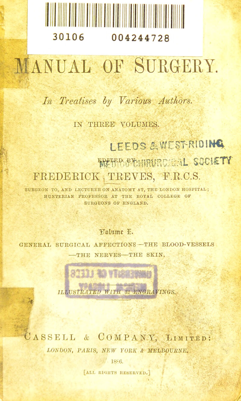 30106 004244728 I Manual of surgery. In Treatises by Variot£S Authors. IN THllEE' VOLUMES. LEEDS «E§T-.RtOIN€V FREDEEICK .JCEEVES, E.E.C.S. SUROEON TO, AND LECTCRER ON ANATOMY AT, THE lONDON HOSPITAL; HnKTEEIAN PnOFESSOB AT THE EOTAL COLLEGE OP SURGEONS OP ENGLAND. TJoIumc E. GENERAL SURGICAL AFFECTIONS—THE BLOOD-VESSELS —THE NERVES—THE SKIN. CaSSEI.L & COMP AjSr.Y, . L i m i t e p LONDON, I'ARIS, NBW YOKK &■ MTShjiOVRNE. I8^C. [am, IIPIIITH HHsmtVED.]