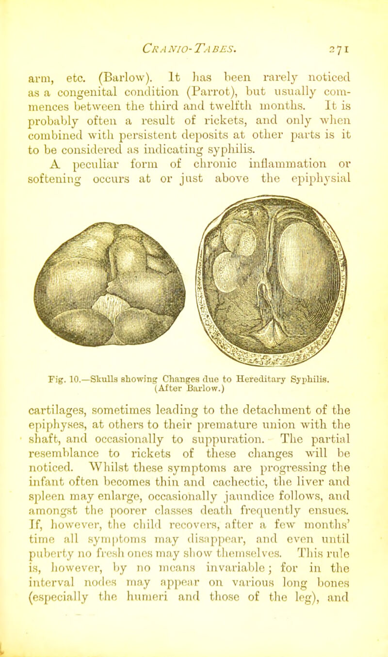 Cranio-Tabes. arm, etc. (Barlow). It lias been rarely noticed as a congenital condition (Parrot), but usually com- mences between the third and twelfth months. It is pi'obably often a result of rickets, and only wlien combined with jjersistent deposits at other parts is it to be considered as indicating syphilis. A peculiar form of chronic inflammation or* softening occurs at or just above the epiphysial Fig. 10.—SliuUs showing Changes clue to Hereditary Syphilis. (After ISarlow.) cartilages, sometimes leading to the detachment of the epiphyse.s, at othei's to their premature union with the shaft, and occasionally to suppuration. The jDartial resemblance to rickets of these changes will be noticed. Whilst these symptoms are progressing the infant often becomes thin and cachectic, the liver and spleen may enlarge, occasionally jaundice follows, aiid amongst the poorer classes deatli frequently ensues. If, however, the child recovers, after a few months' time all symptoms may disappear, and even until puberty no frcsli ones may show tluiinselves. This rule is, however, liy no means invariable; for in the interval nodes may appear on various long liones (especially the humeri and tiiose of the leg), and