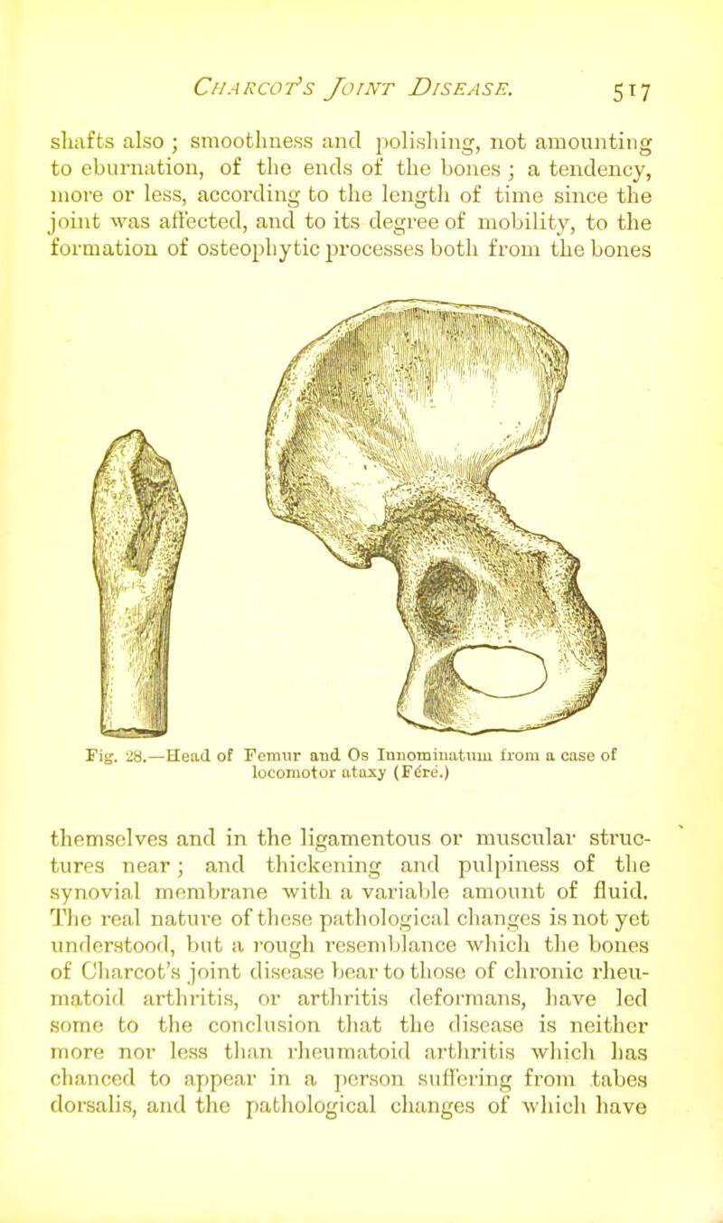 sliafts also ; smoothness and j^olishing, not amounting to eburnation, of the ends of the bones ; a tendency, more or less, according to the length of time since the joint was art'ected, and to its degree of mobility, to the formation of osteophytic i^rocesses both from the bones Fig. 28.—Head of Femur and Os luuomiuatiim from a case of locomotor ataxy (Fdre.) themselves and in the ligamentous or muscular struc- tures near; and thickening and pulpiness of the synovial membrane with a variable amount of fluid. The real nature of these pathological changes is not yet understood, but a i-ough resemblance which the bones of Charcot's joint disease bear to those of chronic rheu- matoid arthritis, or arthritis deformans, have led some to the conclusion that the disease is neither more nor less than rheumatoid arthritis which has chanced to appear in a j)crson suffering from tabes dorsalis, and the pathological changes of which have