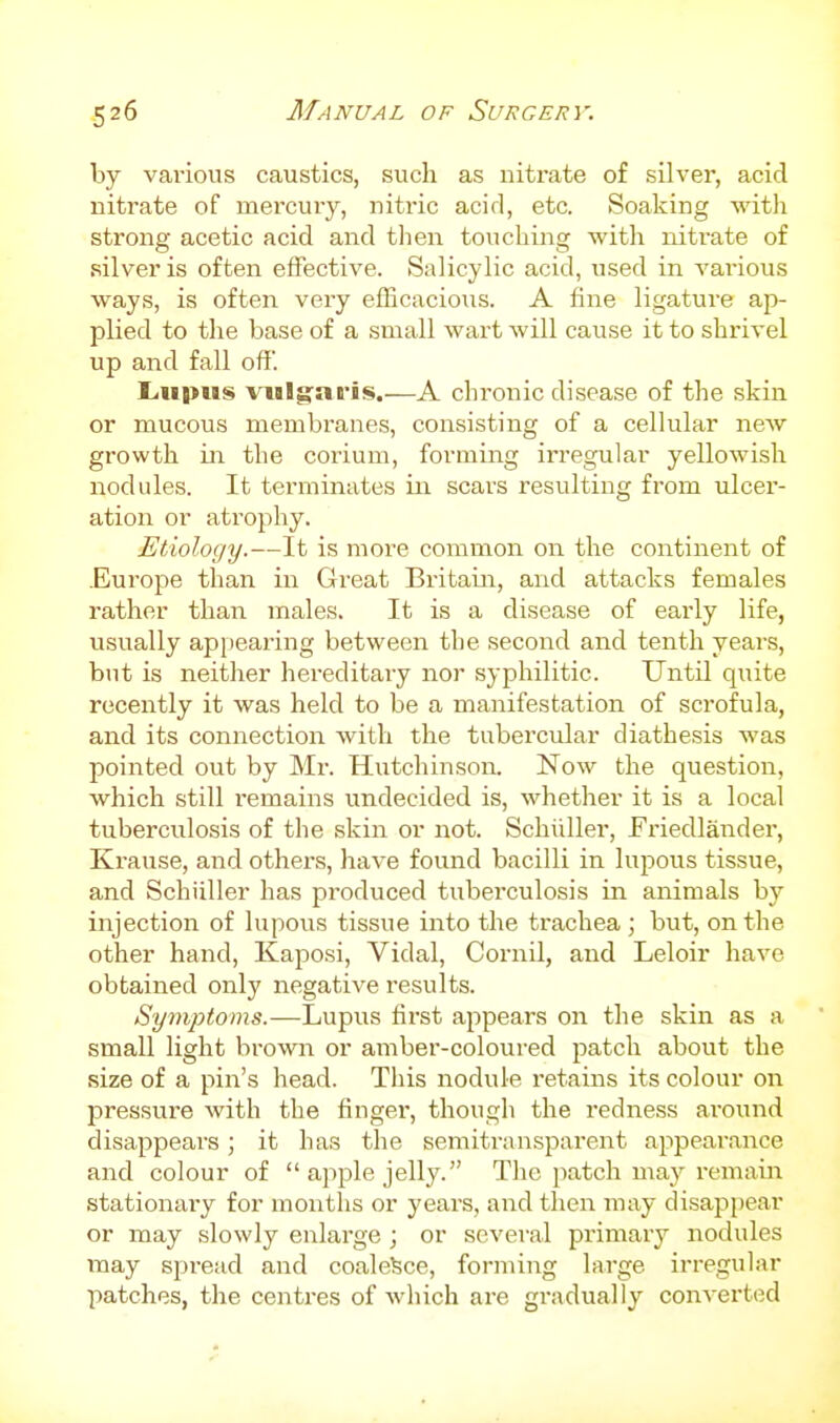 by various caustics, such as nitrate of silver, acid nitrate of mei-cury, nitric acid, etc. Soaking with strong acetic acid and tlien touching with nitrate of silver is often effective. Salicylic acid, used in various ways, is often very efficacious. A fine ligature ap- plied to the base of a small wart will cause it to shrivel up and fall off. Lupus vul^ai-is.—A chronic disease of the skin or mucous membranes, consisting of a cellular new growth in the corium, forming irregular yellowish nodules. It terminates in scars resulting from ulcer- ation or atrophy. Etiology.—It is more common on the continent of Europe than in Great Britain, and attacks females rather than males. It is a disease of early life, usually ap})earing between the second and tenth years, but is neither hereditary nor syphilitic. Until quite recently it was held to be a manifestation of sci'ofula, and its connection with the tubercular diathesis was pointed out by Mr. Hutchinson. Now the question, which still remains undecided is, whether it is a local tuberculosis of the skin or not. Schiiller, Friedlander, Krause, and others, have found bacilli in lupous tissue, and Schiiller has produced tuberculosis in animals by injection of lupous tissue into the trachea; but, on the other hand, Kaposi, Vidal, Cornil, and Leloir have obtained only negative results. Symptoms.—Lupus first appears on the skin as a small light brown or amber-coloured patch about the size of a pin's head. This nodule I'etains its colour on pressure with the finger, though the redness ai'ound disappears; it has the semitransparent appearance and colour of  apple jelly. The patch may remain stationai'y for months or years, and then may disappear or may slowly enlarge ; or several primary nodules may spread and coalesce, forming large irregular patches, the centres of which are gi-adually converted