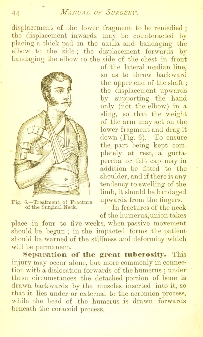 displacement of the lower fragment to be remedied ; the displacement inwards may be counteracted by l)lacing a thick pad in the axilla and bandaging the elbow to the side; the displacement forwards by bandaging the elbow to the side of the chest in front of the lateral median line, so as to throw backward the upper end of the shaft; the displacement upwai'ds by supporting the hand only (not the elbow) in a sling, so that the weight of the arm may act on the lower fragment and drag it down (Fig. 6). To ensure the. part being kej^t com- pletely at rest, a gutta- percha or felt cap may in addition be fitted to the shoulder, and if there is any tendency to swelling of the limb, it should be bandaged Fig. e.-Treatment of Fracture pwards from the fingers. of the Surgical Neck. In fractures of the neck of the humerus, union takes place in four to five weeks, when passive movement should be begun ; in the impacted forms the patient should be warned of the stiffness and deformity which will be permanent. Separation of the great tuberosity.—This injury may occur alone, but more commonly in connec- tion with a dislocation forwards of the humerus ; under these circumstances the detached portion of bone is ch-awn I)ackwards by the muscles inserted into it, so that it lies under or external to the acromion process, while the head of the humerus is drawn forwards beneath the coracoid jjrocess.