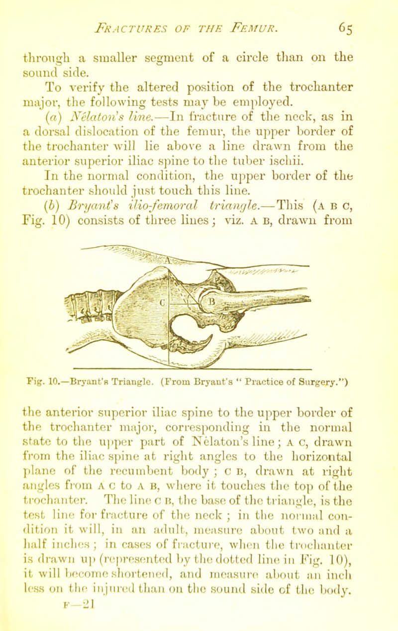 throiish a smaller segment of a circle tlian on the sound side. To verify the altered position of the trochanter major, the following tests may be employed. («) Nelaton's line.—In fracture of the neck, as in a dorsal dislocatioia of the femur, the upper border of the trochanter will lie above a line drawn from the anterior superior iliac spine to the tuber ischii. In the normal condition, the upper border of the trochanter shoidd just touch this line. {b) Bryant's ilio-femoral triangle.—This (a b c, Fig. 10) consists of three lines; viz. A b, drawn from Fig. 10.—Bryant's Triangle. (From Bryant's  Practice of Surgery.) the anterior superior iliac spine to the upper boixler of the trochanter major, corresponding in the normal state to the u]iper part of Nelaton's line; A c, drawn from the iliac spine at right angles to the horizontal plane of the recumbent body ; c b, drawn at right angles fi om A c to A B, where it touches the top of the trochanter. The lino c B, tlie base of the triangle, is the test line for fracture of the neck ; in the normal con- dition it will, in an adult, measure about two and a half inches ; in cases of fi iicture, w]i(!ii tlie trochanter is drawn up (rcjjresented by the dotted line in Fig. 10), it will Iiccome sliortened, and measure al)()ut an inch less on tlie injured tiuiu on tlie sound side of the body. F-2I