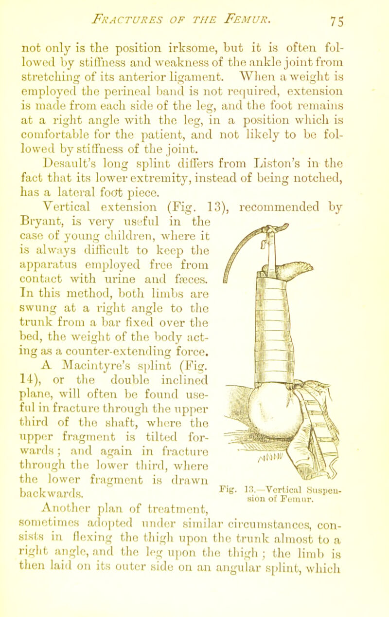 not only is the position irksome, but it is often fol- lowed by stiffness and weakness of the ankle joint from stretching of its anterior ligament. When a weight is employed the perineal band is not required, extension is made from each side of the leg, and the foot remains at a right angle with the leg, in a position which is comfortable for the patient, and not likely to be fol- lowed by stiffness of the joint. Desault's long splint differs from Liston's in the fact that its lower extremity, instead of being notched, has a lateral focrt piece. Vertical extension (Fig. 13), recommended by Bryant, is very useful in the case of young children, where it is always difhcult to keep the apparatus employed free from contact ^vith urine and fajces. In this method, both lindjs are swung at a right angle to the trunk from a bar fixed over the bed, the weight of the body act- ing as a counter-extending force. A Macintyre's s|)lint (Fig. 14), or the double inclined plane, will often be found use- ful in fractui-e through the upper third of th(; shaft, whore the upper fragm(Mit is tilted for- wards ; and again in fracture thi-ough the lower third, where the lower fi-agmcnt is drawn backwards. Another plan of treatment, .sometimes adopted under simil;ir circumstances, con- sists in flexing the thigh upon the truidc almost to a right angle, and the leg upon the; thigh ; the lind) is then laid on its outer side on an angular splint, which Vcrliciil .Suspeu- sion of Femur.