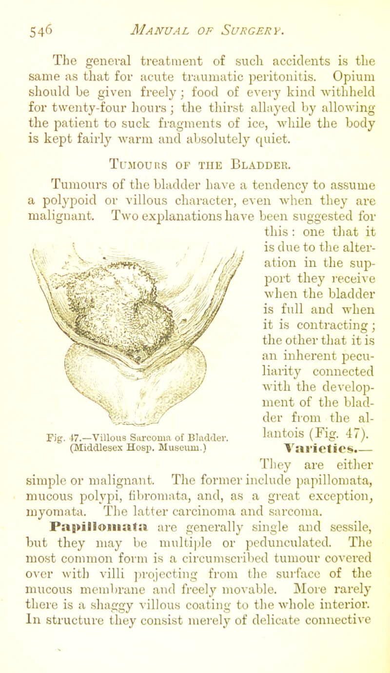 The general treatment of such accidents is the same as that for acute traumatic peritonitis. Opium should be given freely ; food of every kind withheld for twenty-four hours ; the thirst allayed by allowing the patient to suck fragments of ice, while the body is kept fairly warm and absolutely ciuiet. Tumours of the Bladder. Tumours of the bladder have a tendency to assume a polypoid or villous character, even when they are malignant. Two exj^lanations have been suggested for this : one that it is due to the alter- ation in the sup- port they receive when the bladder is full and when it is contracting; the other that it is an inherent pecu- liarity connected with the develop- ment of the blad- der from the al- lantois (Fig. 47). Viirieties.^— They are either simple or malignant. The former include papillomata, . mucous polyi^i, fibromata, and, as a great exception, myoraata. The latter carcinoma and sarcoma. Pa{>illoiiiat:t are generally single and sessile, but they may be multi|jle or ijedunculatcd. The most connnon form is a circumscribed tumour covered over with villi jirojecting from the surface of the mucous membrane and freelj' movable. More rarely there is a shaggy villous coating to the whole interior. In structure they consist merely of delicate connective Fig. J-?.—Villous Siii-coma of Bladder. (Middlesex Hosp. Museimi.)