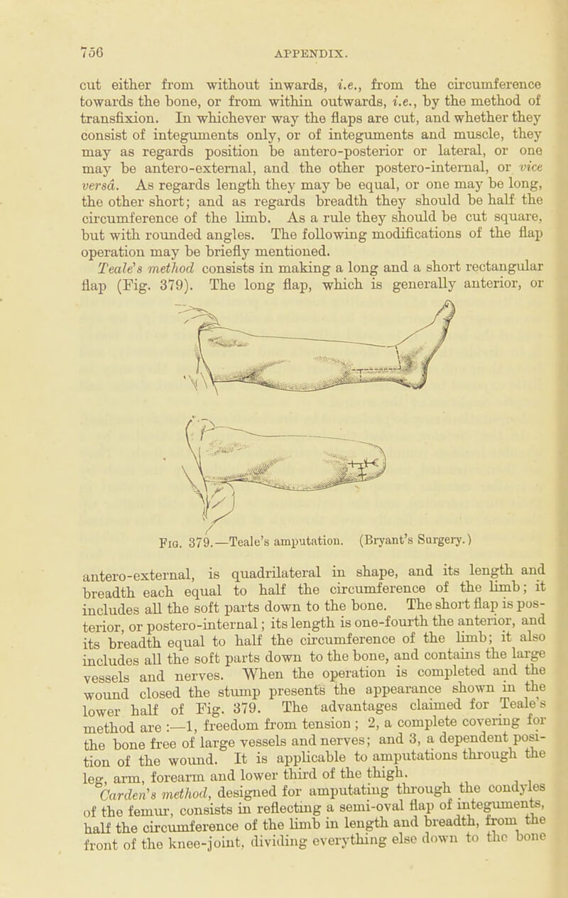 cut either from without inwards, i.e., from the cii’cumference towards the bone, or from within outwards, i.e., by the method of transfixion. In whichever way the flaps are cut, and whether they consist of integuments only, or of integuments and muscle, they may as regards position be antero-posterior or lateral, or one may be antero-extemal, and the other postero-internal, or vice versa. As regards length they may be equal, or one may be long, the other short; and as regards breadth they should be half the circumference of the limb. As a rule they should be cut square, but with rounded angles. The following modifications of the flap operation may be briefly mentioned. Teale’s method consists in making a long and a short rectangular flap (Fig. 379). The long flap, which is generally anterior, or / Fia. 379.—Teale’s amputation. (Bryant’s Surgery.) antero-external, is quadrilateral in shape, and its length and breadth each equal to half the circumference of the limb; it includes aU the soft parts down to the bone. The short flap is pos¬ terior, or postero-internal; its length is one-foui-th the anterior, and its breadth equal to half the circumference of the limb; it also includes all the soft parts down to the bone, and contains the large vessels and nerves. When the operation is completed and the wound closed the stump presents the appearance shown m the lower half of Fig. 379. The advantages claimed for Teales method are 1, fr-eedom fr’om tension ; 2, a complete covering for the bone free of large vessels and nerves; and 3, a dependent posi¬ tion of the wound. It is appUcable to amputations thi-ough the leg, arm, foreann and lower third of the thigh. Carden's method, designed for amputating thi’ough the condyles of the femui-, consists in reflectuig a semi-oval flap of mteg^ente, half the circumference of the limb in length and breadth, from tlie front of the knee-joint, diviiUng everything else down to the bone