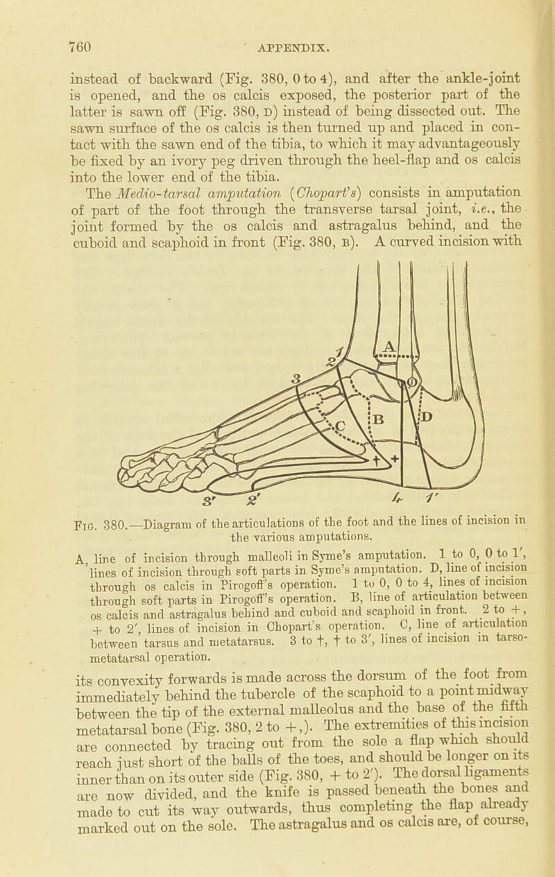 instead of backward (Fig. 380, 0 to 4), and after the ankle-joint is opened, and the os calcis exposed, tbe posterior part of tbe latter is sawn off (Fig. 380, d) instead of being dissected out. Tbe sawn sui’face of tbe os calcis is then turned up and placed in con¬ tact witb tbe sawn end of tbe tibia, to wbicb it may advantageously be fixed by an ivory peg driven tbrougb tbe beel-flap and os calcis into tbe lower end of tbe tibia. The Medio-tarsal amputation (Chopart’s) consists in amputation of part of tbe foot tbrougb tbe transverse tarsal joint, i.e., tbe joint formed by tbe os calcis and astragalus bebind, and tbe cuboid and scaphoid in front (Fig. 380, b). A curved incision witb Fig. 380.—Diagram of the articulations of the foot and the lines of incision in the various amputations. A line of incision through malleoli in Syme’s amputation. 1 to 0, 0 to 1', ’lines of incision through soft parts in Syme’s amputation. D, line of incision through os calcis in Pirogoff’s operation. 1 to 0, 0 to 4, lines of incision through soft parts in Pirogoifs operation. B, line of artioulation between os calcis and astragalus behind and cuboid and scaphoid in front. 2 + to 2', lines of incision in Chopart’s operation. C, line of articulation between tarsus and metatarsus. 3 to f, t to 3', lines of incision in tarso¬ metatarsal operation. its convexity forwards is made across tbe dorsum of tbe foot from immediately bebind tbe tubercle of tbe scaphoid to a point midway between tbe tip of tbe external malleolus and tbe base of tbe fifth metatarsal bone (Fig. 380, 2 to -b,). The extremitms of ^s incision are connected by tracing out from tbe sole a flap which sboidd reach just short of tbe baUs of tbe toes, and should be longer on its inner 4an on its outer side (Fig. 380, -b to 2'). The dorsal bgaments are now divided, and tbe knife is passed beneath the bones and made to cut its way outwards, thus completing the flap ali-eady marked out on tbe sole. Tbe astragalus and os calcis are, of course,