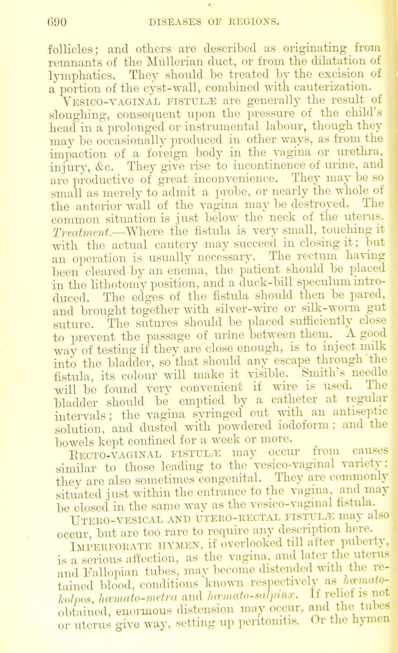 follicles; and others are described as originating from remnants of the Miillerian duct, or from the dilatation of lymphatics. They should ho ti'oated by the excision of a* jiortiou of the cyst-wall, combined with cauterization. Vesico-vaginal FiSTULyTi are generally the result of sloughing, conseriuent upon the pressure of the child's head in a pi'olonged or instrumental labour, though they may be occasionally produced iu other ways, as from the impaction of a foreign body in the vagina or lu-ethi-a, injury, &c. They give rise to incontinence of urine, and are productive of great inconvenience. They may be so small as merely to admit a probe, or nearly the whole of the anterior wall of the vagina may be destroyed. The common situation is just below the neck of the uterus. Trmtnu-nt.—Where the fistula is very small, touching it with the actual cautery may succeed in closing it; but an operation is usually necessary. The rectum having been cleared by an enema, the patient should be placed in the lithotomy position, and a duck-bill speculum inti-o- duced. The edges of the fistula should then be pared, and brought together with silver-wii'e or silk-worm gut suture. The sutui-es should be placed sufficiently close to prevent the passage of urine between theni. _ A good way of testing if thev are close enough, is to inject milk into the bladder, so'that should any escape through the fistula, its colour will make it visible. Smith's needle will be found very convenient if wire is used. The bladder should be emptied by a catheter at regular intervals; the vagina svringcd out with an antiseptic solution, and dusted with powdered iodoform ; and the bowels kept confined for a week or more. Eecto-vagin.sx eistul.e may occur from causes similar to those leading to the vesico-vaginal varietv; they are also sometimes congenital. They are conmionly sitiiatcd just within the entrance to the vagina, and may be closed in the same way as the vesico-vagmal fistula. Utkko-vestcal and itteho-kect.vi. riSTi-L-E may also occur, but are too rare to require any description here. Ijii'EUFOKATE UYMEX. if overlooked till after ]niborty, is a serious affection, as the vagina, and later the uterus •uul Falloiiian tubes, may become distended with the re- tained blood, conditions kno^^^l respectively -^s ha'imdo- h,lpn.% ha wato-mrtra and Invmato-salpin.r. If relict is not )taiucd enormous distension may occur, and the tubes -ivo way. setting' uji peritonitis. Or the hymen oDl or uterus