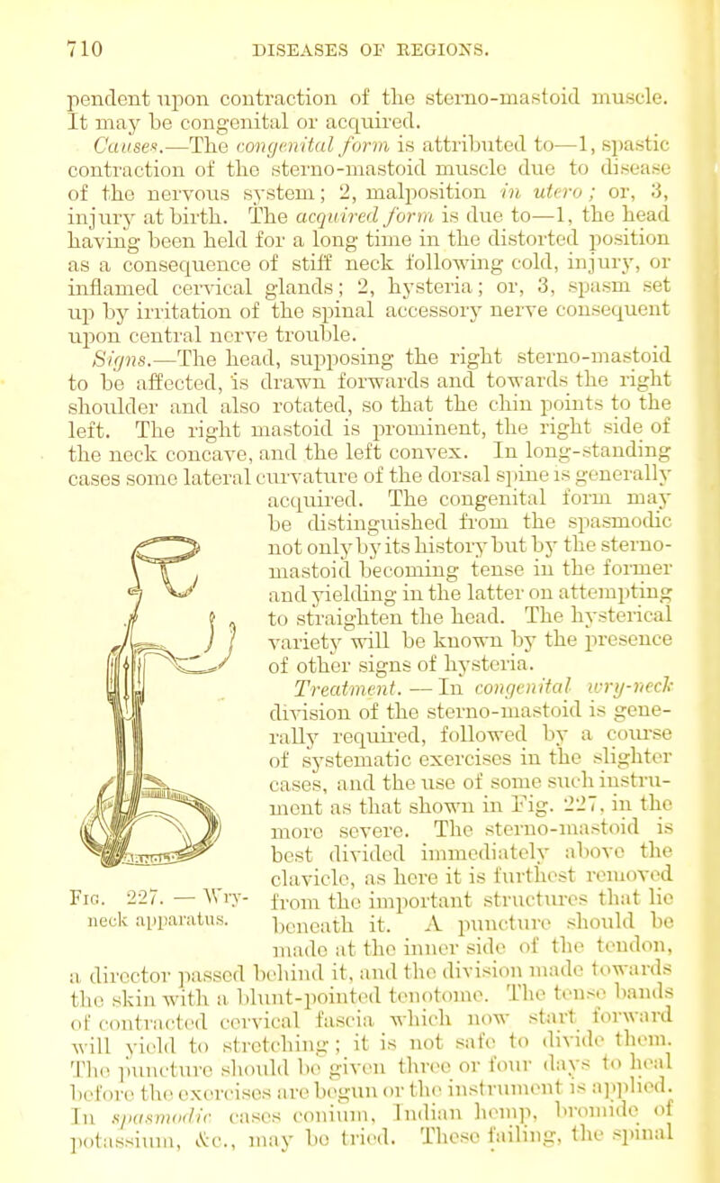 pendent upon contraction of tlie sterno-niastoid muscle. It may be congenital or acquii'ed. Cause>!.—The congenital form is attributed to—1, spastic contraction of the sterno-mastoid muscle due to disease of the nervous system; 2, malposition in utcro ; or, 3, injury at birth. The acquired form is due to—1, the head having been held for a long time in the distorted position as a consequence of stiif neck following cold, injury, or inflamed cervical glands; 2, hysteria; or, 3, spasm set up by irritation of the spiual accessory nerve consequent upon centi'al nerve trouble. Signs.—The head, supposing the right sterno-mastoid to be affected, is drawn forwards and towards the right shoulder and also rotated, so that the chin points to the left. The right mastoid is prominent, the right side of the neck concave, and the left convex. In long-standing cases some lateral cruwature of the dorsal si)ine is generally acquii'ed. The congenital form may be distinguished fi'om the spasmochc not only by its history but by the sterno- mastoid becoming tense in the fonner and yielding in the latter on attempting to straighten the head. The hysterical variety will be known by the presence of other signs of hysteria. Treatment.—In congenital u-rij-necl: division of the sterno-mastoid is gene- rally requii-ed, followed by a com-se of systematic exercises in the slighter cases, and the use of some such instru- ment as that shown in Fig. 227, in the more severe. The sterno-mastoid is best divided immediately above the clavicle, as here it is furthest removed Fig. 2-27. — Wry- iVom the important structures that lie neck apparatus. beneath it. A puncture should be made at the inner side of the tendon, a director passed behind it, and the division made towards the skin with a blunt-pointed tenotome. Tlie tense bands of c(nitracted cervical fascia, which now start forward will yield to stretching ; it is not safe to divide them. Tlie ])uncture should bi'^ given three or four days to lieal before the exercises are begun or the instrmnent is a])]ihod. In njHU^modie cases coniuin. Indian lieiiqi, bromide of liota,ssium, .^c, may be tried. Tliesc failing, the .spinal