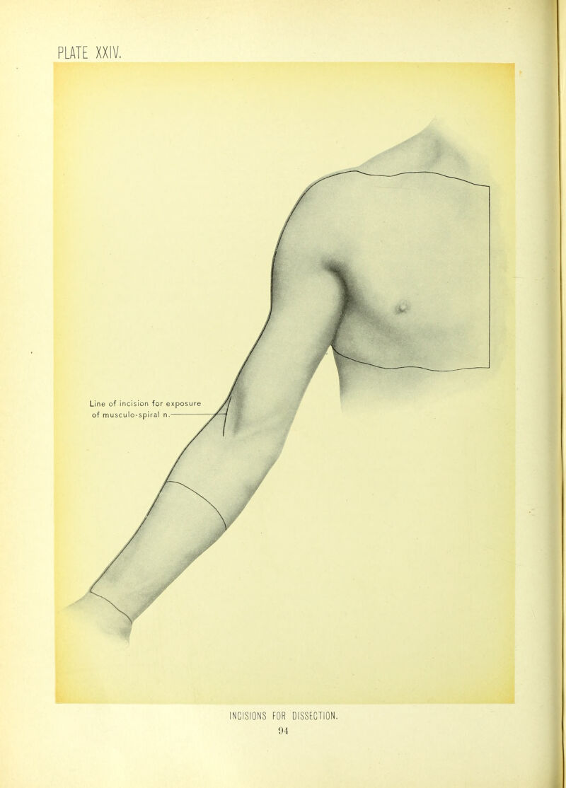 INCISIONS FOR DISSECTION