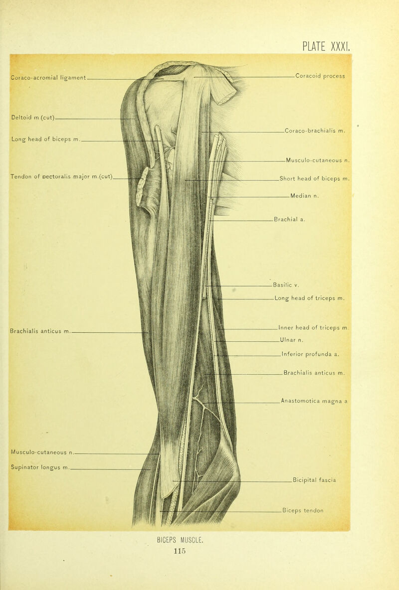 Coraco-acromial ligament- Deltoid m,(cut)- Long head of biceps m. Tendon of oectoralis major m.(cut)_ Brachialis anticus m.- Musculo-cutaneous n. Supinator longus m._ BICEPS MUSCLE. 115 -Coracoid process -Coraco-brachialis m, -Musculo-cutaneous n. -Short head of biceps m. Median n. -Brachial a. -Basilic V. -Long head of triceps m, Inner head of triceps rr -Ulnar n. ..Inferior profunda a. — Brachialis anticus m. .Anastomotica magna a -Bicipital fascia -Biceps tendon