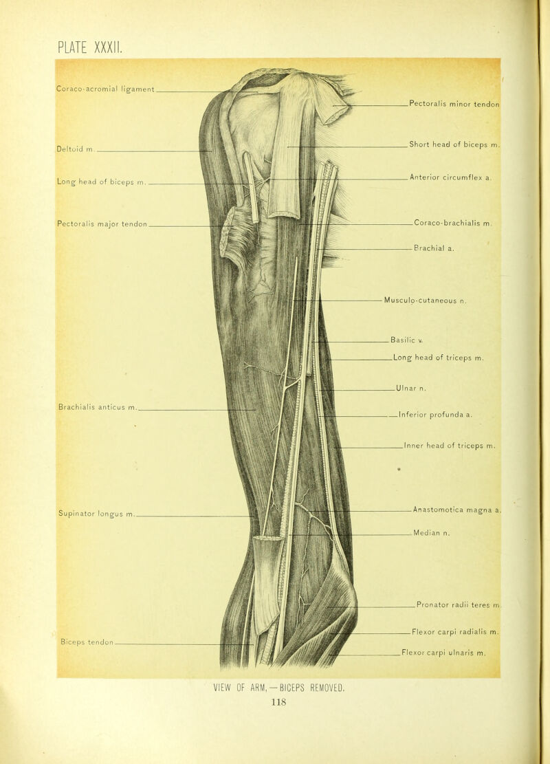 Coraco-acromial ligament. Deltoid m.. Long head of biceps m. Pectoralis major tendon. Brachialis anticus m. Supinator longus m._ Biceps tendon. VIEW OF ARM,-BICEPS REMOVED, 118 -Pectoralis minor tendon .Short head of biceps m, .Anterior circumflex a. — Coraco-brachialis m. — Brachial a. Musculo-cutaneous n. .Basilic V, _Long head of triceps m. -Ulnar n. .Inferior profunda a. .Inner head of triceps -Anastomotica magna a. -Median n. .Pronator radii teres Flexor carpi radialis m.