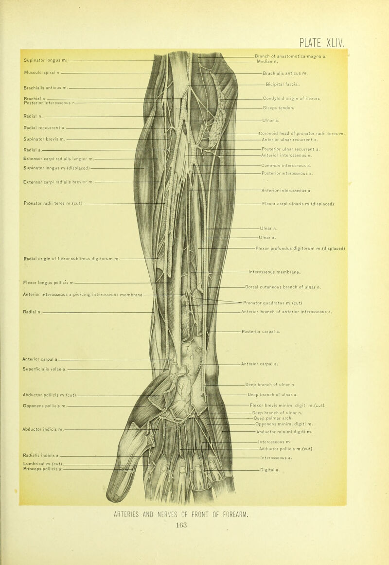 Supinator longus m, Musculo-spira Brachialls anticus m Brachial a Posterior interosseous n Radial n Radial reccurrent a Supinator brevis m, Radial a Extensor carpi radialii lonrior m Supinator longus m.(displaced) Extensor carpi radialis brevior m Pronator radii te-'es m.(cutl Radial origin of flexor sublimes digitorum m Branch of anastomotica magna a. Median n. Brachialis anticus m. Bicipital fascia. Condyloid origin of flexors Biceps tendon. Coronoid head of pronator radii teres nn. Anterior ulnar recurrent a. Posterior ulnar recurrent a. Anterior interosseous n. Common interoseous a. Posteriormterosseous a. Anterior interosseous a. l-leXor carpi ulnaris m,(displaced) Flexor profundus digitorum m.(displaced) Interosseous membrane. Flexor longus polllcis m Anterior interosseous a.piercing interosseous membrane Radial n. Dorsal cutaneous branch of ulnar n. Pronator quadratus m.(cut) Anterior branch of anterior interosseous a. Anterior carpal a Superficialis volae a Abductor pollicis m/cut) Opponens pollicis m Abductor indlcis m Radialis indicis a. Lumbrica! m.(cut) Princeps pollicis a. Deep branch of ulnar n. Deep branch of ulnar a. Flexor brevis minimi digiti m.(cut) Deep branch of ulnar n. Deep palmar archi Opponens minimi digiti m. Abductor minimi digiti m. 1 nterosseous m. Adductor pollicis m.Ccut) Interosseous a, Digital a. ARTERIES NERVES OF FRONT OF FOREARM.