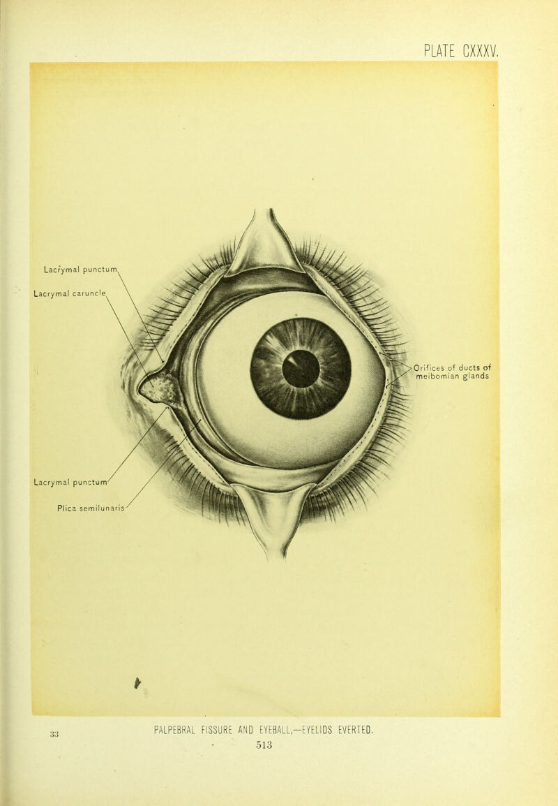 'Orifices of ducts 0+ meibomian glands 33 PALPEBRAL FISSURE AND EYEBALL-EYELIDS EVERTED,