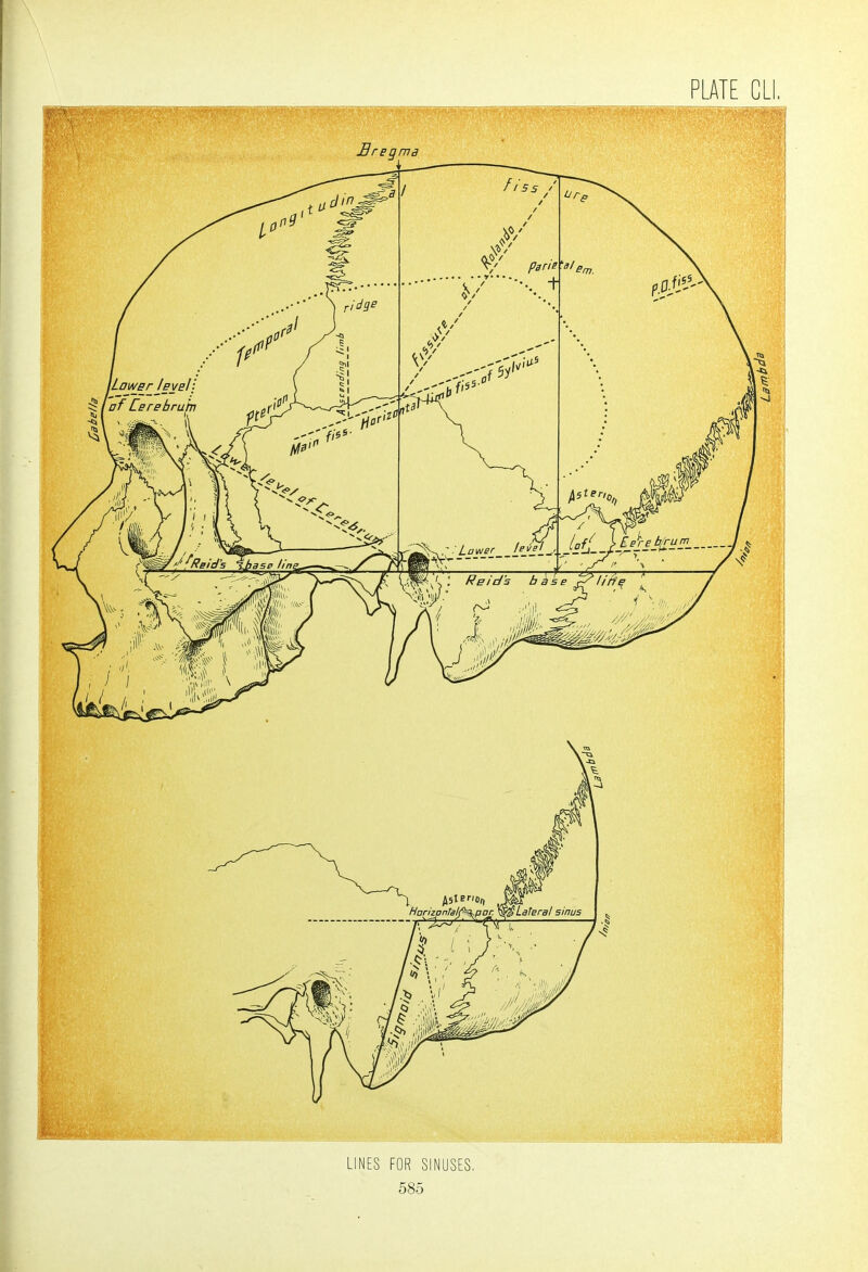 LINES FOR SINUSES,