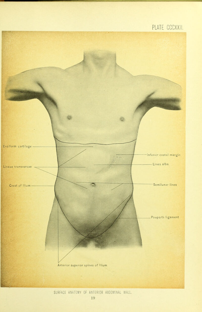 PLATE CCCXXII, Anterior superior spines of Ilium SURFACE ANATOMY OF ANTERIOR ABDOMINAL WALL,