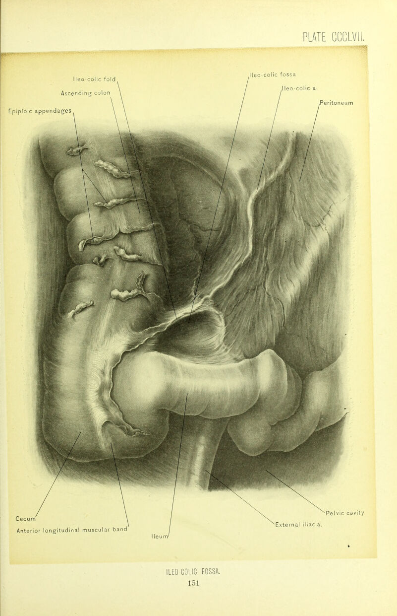 ILEO-COLIC FOSSA.