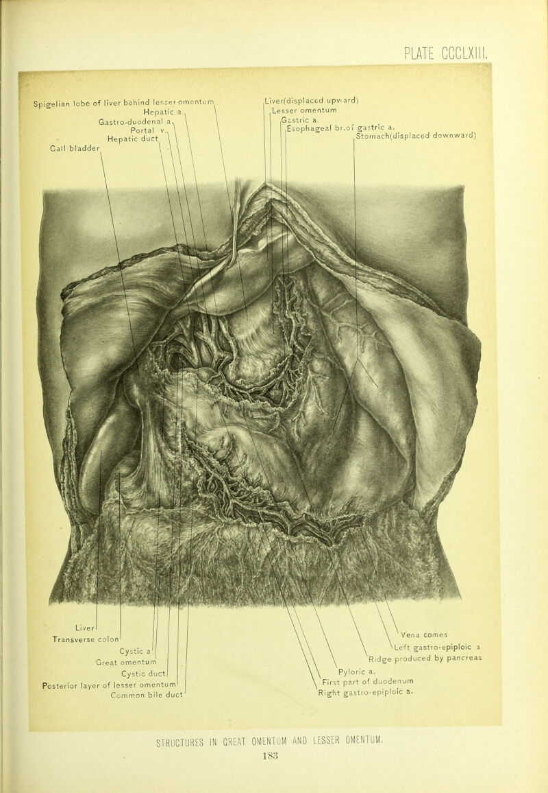 Spigelian lobe of liver behind lesser omentum Hepatic a Gastro-duodenal Portal V Hepatic duct Call bladder Liver(displaced upward) Lesser omentum Gastric a. Esophageal br.oi gastric a. Stomach(displaced downward) Liver Transverse colon Cystic a Great omentum Cystic duct Posterior layer of lesser omentum Comm.on bile duct Vena comes Left gastro-epiploic a Ridge produced by pancreas Pyloric a. First part of duodenum Right gastro-epiploic a. STRUCTURES IN GREAT OMENTUM AND LESSER OMENTUM