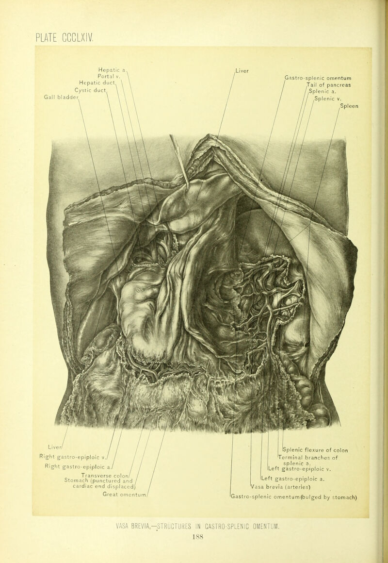 VASA BREVIA-STRUCTURES IN GASTRO-SPLENIC OMENTUM