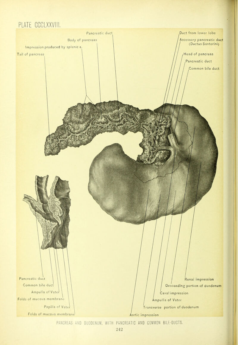 Pancreatic duct i Body of pancreas Impression produced by splenic a Tail of pancreas .Duct from lower lobe Accessory pancreatic duct (Ductus Santorini) Head of pancreas Pancreatic duct Common bile duct Pancreatic duct Common bile duct Ampulla of Vater Folds of mucous membrane Papilla of Vater Folds of mucous membrane' Renal impression ding portion of duodenum Caval impression Ampulla of Vater Transverse portion of duodenum Aortic Impression PANCREAS AND DUODENUM, WITH PANCREATIC AND 242 BILE-DUCTS. i