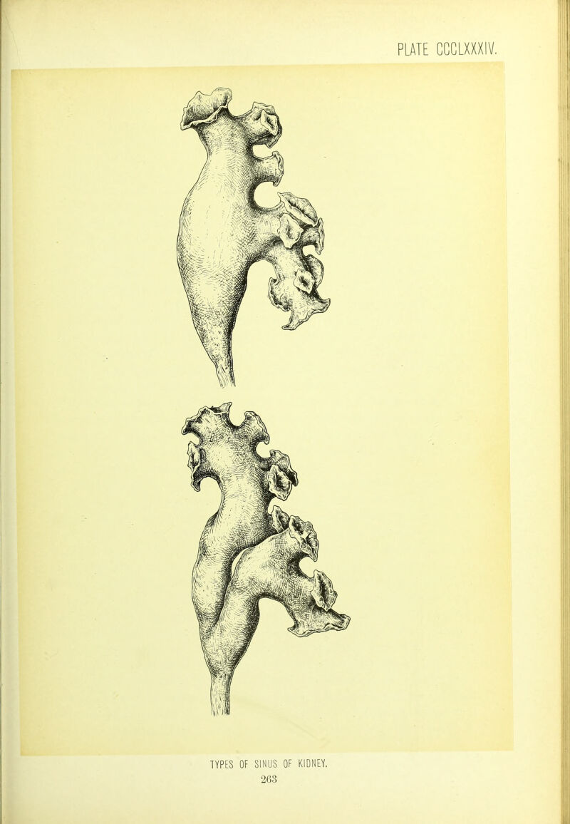 TYPES OF SINUS OF KIDNEY.