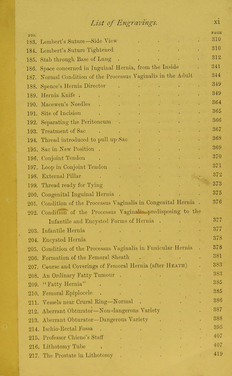 PAGE FIO. 183. Lembert's Suture—Side View . . • .310 184. Lembert's Suture Tightened . • • .310 185. Stab tlirougli Base of Lung . . • • • 312 186. Spa«e ooncerued in Inguinal Heruia, from the Inside . 341 187. Normal Condition of the Processus Vaginalis in the Adult 344 188. Spence's Hernia Director ..... 349 189. Heruia Knife 349 190. Macewen's Needles . . . . • .364 191. Site of Incision 365 192. Separating the Peritoneum . . . . • 366 193. Treatment of Sac . . . . • • 367 194. Thread introduced to pull up Sac .... 368 l'95. Sac in New Position ...... 369 196. Conjoint Tendon ...... 370 197. Loop in Conjoint Tendon . . . ■ • 371 198. E.\;ternal Pillar ....... 372 ; 199. Thread ready for Tying . ... ■ .373 I 200. Congenital Inguinal Hernia ..... 375 201. Condition of the Processus Vaginalis in Congenital Hernia . 376 202. Condition of the Processus Vaginafeu-predisposing to the ' Infantile and Encysted Forms of Hernia . . .377 203. Infantile Heniia ...... 377 204. Encysted Hernia ...... 378 205. Condition of the Processus Vaginalis in Funicular Hernia . 378 206. Formation of the Femoral Sheath .... 381 207. Course and Coverings of Femoral Hernia (after Heath) . 383 208. An Ordinary Fatty Tumour ..... 383 209. Fatty Hernia ...... 385 210. Femoral Epiplocele ...... 385 j 211. Vessels near Crural Ring—Normal . . . .386 212. Aberrant Obturator—Non-dangerous Variety . . 387 \ 213. Aberrant Obturator—Dangerous Variety . . 388 ■ 214. Ischio-Rectal Fossa ...... 395 215. Profes.sor Chiene's Stall' . 407 j 216. Lithotomy Tube ...... 407 217. The Prostate in Lithotomy . . . . • 419