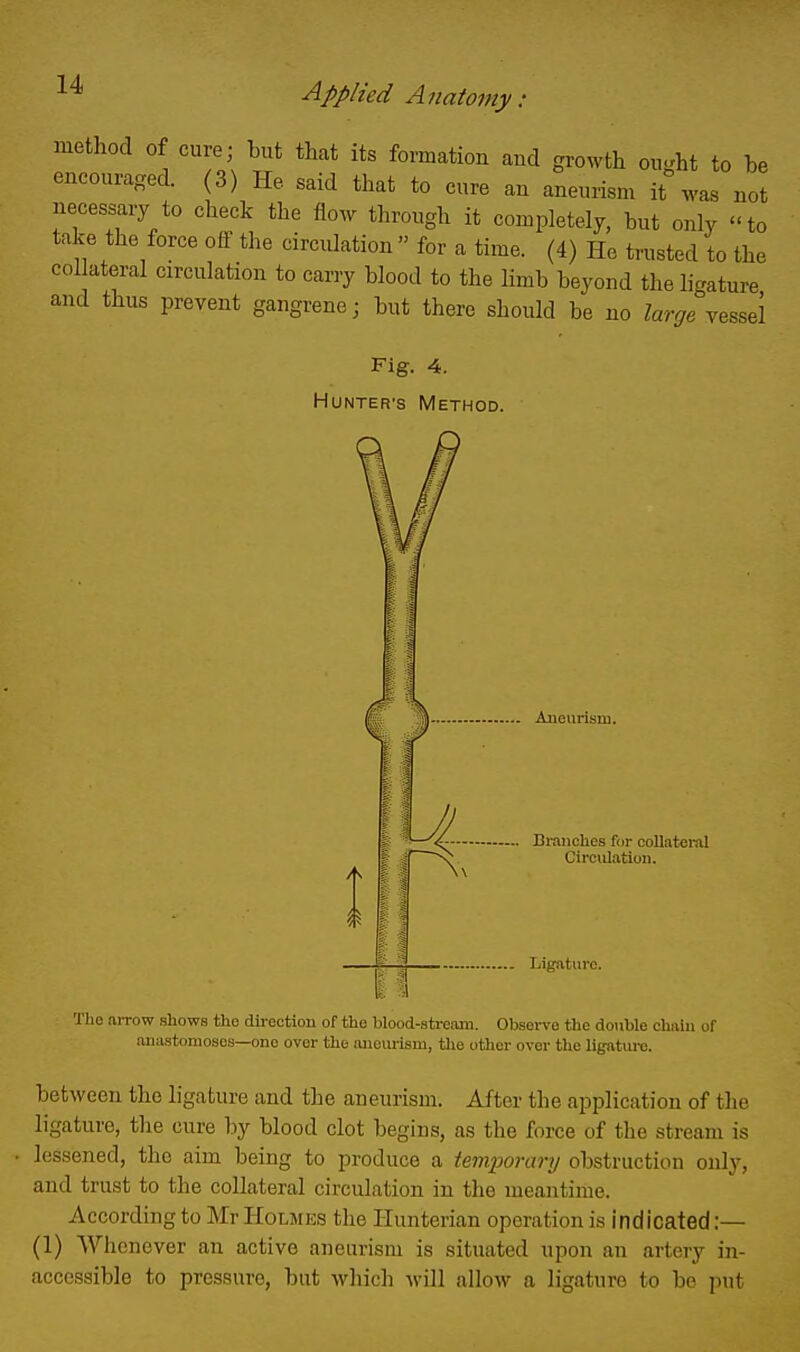 method of cure; but that its formation and growth ou-ht to be encouraged. (3) He said that to cure an aneurism it was not necessary to check the flow through it completely, but only to take the force off the circulation  for a time. (4) He trusted to the collateral circulation to carry blood to the limb beyond the li-ature and thus prevent gangrene; but there should be no Zar^e^vessel Fig. 4. HUNTER'S Method. Aneurism. Branches for collateral Circulation. Ligature. The arrow shows the direction of the blood-stream. Observe the double chain of anastomoses—one over the aiieiu-ism, the other over the ligature. between the ligature and the aneurism. After the application of the ligature, the cure by blood clot begins, as the force of the stream is lessened, the aim being to produce a temporary obstruction only, and trust to the collateral circulation in the meantime. According to Mr Holmes the Hunterian operation is indicated:— (1) Whenever an active aneurism is situated upon an artery in- accessible to pressure, but which Avill allow a ligature to be put