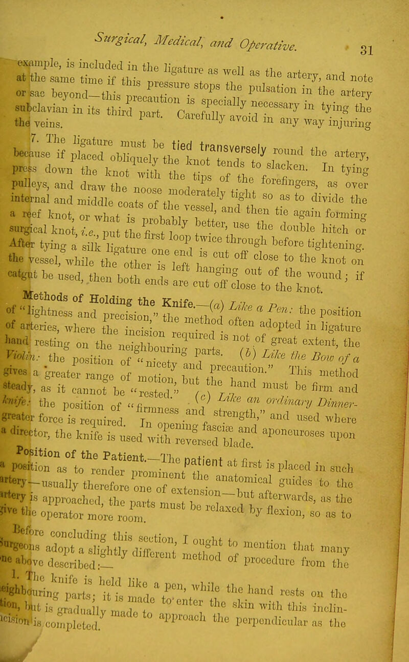 or sac bevonrl ihia f piubciaon m tne cartery u«j ona tjais precaution is specially necessnrv Jn f, • ^/ subclavian in its third nart ror.fnii .^^^^^^'^^^ tying the thd veins. ^ ^''^^^^ ''^^^^^^ a^iy ^vay injuring Pre^s down^^e^.n? r L0^^^^^ ^-^^^ pulleys, and draw the nno«l 1 ^! , forefingers, as over internal and niidrcLron^^^^^^^^^^^ ^ ^ ^^-^^^^ the a reef knot, or what is ^v22^ T t ''^^'^ ^™^g surgicalkno ,^• tlS ^ ^''ir ^^^ ^^^^^^ ^^^^^^ - Ai^- tying a' '''''' the vessel, while the other is feffl c^^-he used, then hothi;UfrS^^^^^^^^^^ 0^ nf ~ T ^ ^^^^ '^-^-^ of aperies, where t^I^e Son^^^^^^^^^^ ^^^^^^^^ hand resting on the neighbourinrparL wf' t''' the position of r,,-.o+ V ^ ^'^'^ ^^'^ ^'-xlT. as it cannot be . ^ the position of fin„I ■ Aw,-- • Ji-to, .,„4 is .sod w&tS: » ^^^^ P'-d i„ .0. «.e operator ^rfZ » to ™ above doscibsd:!: °' P'o^*™ ftom tl,e ^btinttrt 'ul li', T o„ the co.°,pl °7 ^ P<'l'™''i<=«Iar as the