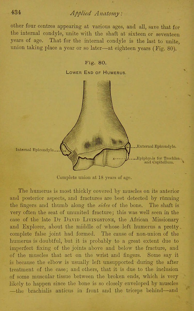 other four centres appearing at various ages, and all, save that for the internal condyle, unite with the shaft at sixteen or seventeen years of age. That for the internal condyle is the last to unite, union taking place a year or so later—at eighteen years (Fig. 80). Fig. 80. Lower End of Humerus. Intenial Epicondylo__ Complete uuiou at 18 j'eai s of age. The humerus is most thickly covered by muscles on its anterior and posterior aspects, and fractures are best detected by running the lingers and thumb along the sides of the bone. Tlie shaft is very often the seat of ununited fracture; this was well seen in the case of the late Dr David Livingstone, the African Missionary and Explorer, about the middle of whose left humerus a pretty complete false joint had formed. The cause of non-union of the humerus is doubtful, but it is probably to a great extent due to imperfect fixing of the joints above and below the fracture, and of the muscles that act on the wrist and fingers. Some say it is because the elbow is usually left unsupported during the after treatment of the case; and others, that it is due to the inclusion of some muscular tissue between the broken ends, which is very likely to happen since the bone is so closely enveloped by muscles —the brachialis anticus in front and the triceps behind—and