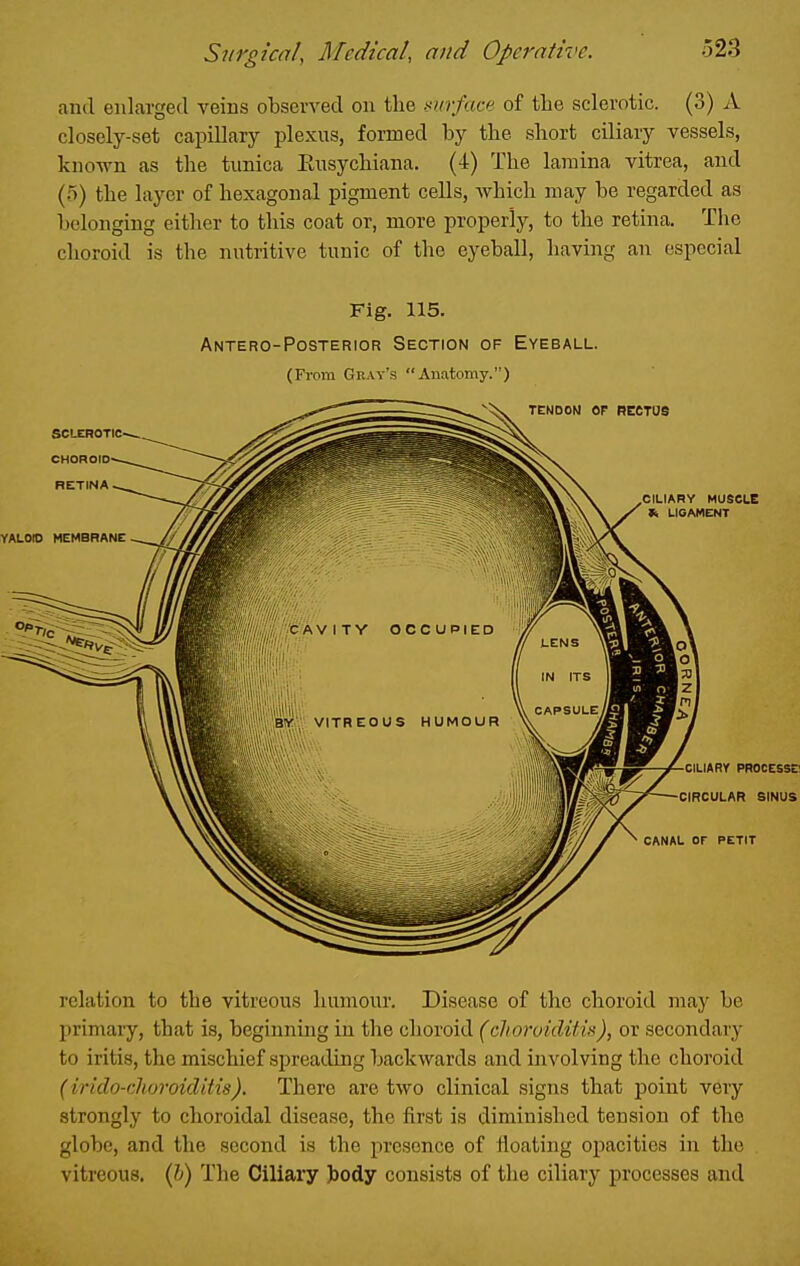 and enlarged veins observed on the surface of the sclerotic. (3) A closely-set capillary plexus, formed by the short ciliary vessels, known as the tunica Ensychiana. (4) The lamina vitrea, and (5) the layer of hexagonal pigment cells, which may be regarded as belonging either to this coat or, more properly, to the retina. The choroid is the nutritive tunic of the eyeball, having an especial Fig. 115. Antero-Posterior Section of Eyeball. (From Cray's Anatomy.) relation to the vitreous humour. Disease of the choroid may be primary, that is, beginning in the choroid (choruiditis), or secondary to iritis, the mischief spreading backwards and involving the choroid (irido-cUoroiclitis). There are two clinical signs that point very strongly to choroidal disease, the first is diminished tension of the globe, and the second is the presence of floating opacities in the vitreous, {h) The Ciliary J)ocly consists of the ciliary processes and