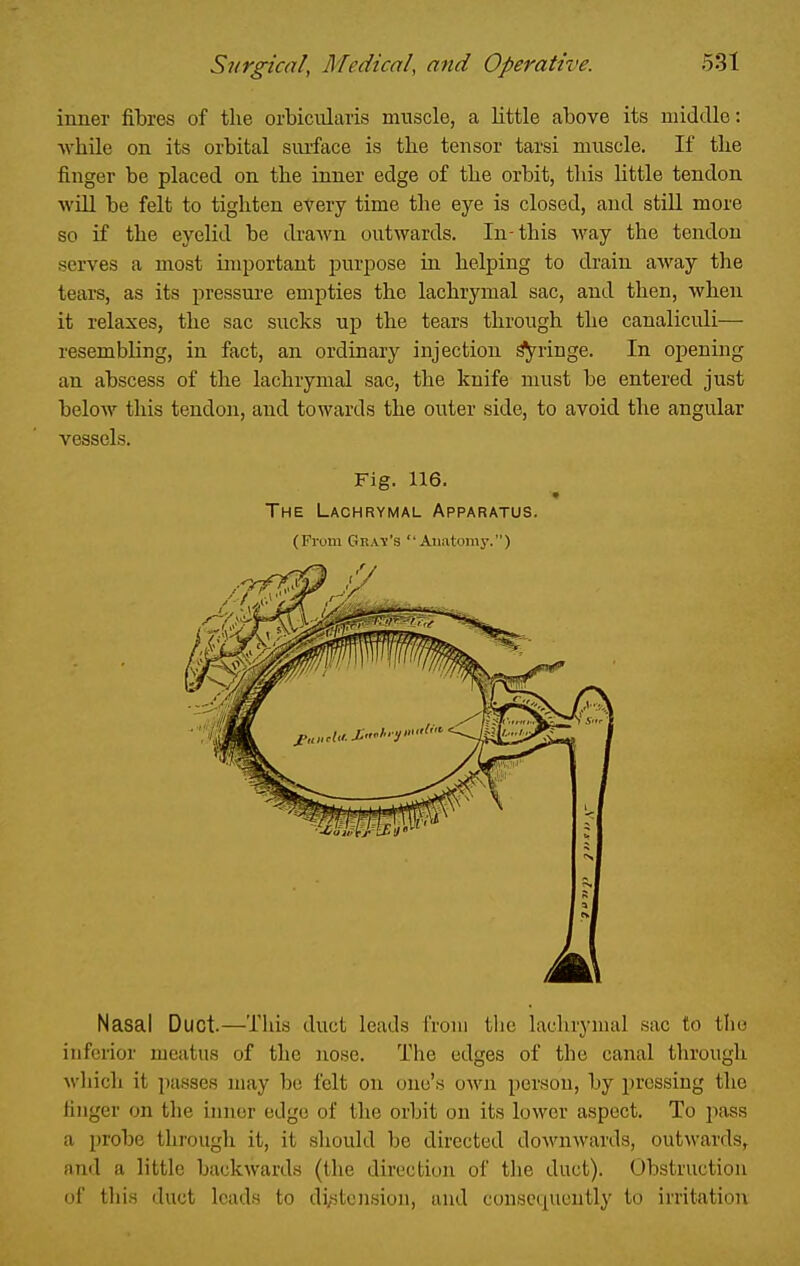 inner fibres of the orbicularis muscle, a little above its middle: while on its orbital surface is the tensor tarsi muscle. If the finger be placed on the inner edge of the orbit, this little tendon will be felt to tighten every time the eye is closed, and still more so if the eyelid be di-awn outwards. In-this way the tendon serves a most important purpose in helping to drain away the tears, as its pressure empties the lachrymal sac, and then, when it relaxes, the sac sucks up the tears through the canaliculi— resembling, in fact, an ordinary injection fringe. In opening an abscess of the lachrymal sac, the knife must be entered just below this tendon, and towards the outer side, to avoid the angular vessels. Fig. 116. The Lachrymal Apparatus. (From Gkay's  Aiiatomy.) Nasal Duct.—This duct leads from the lachrymal sac to the inferior meatus of the nose. The edges of the canal through whicli it passes may be felt on one's own person, by pressing the finger on the inner edge of the orbit on its lower aspect. To pass a probe through it, it should be directed downwards, out\vards, and a little back^vards (the direction of the duct). Obstruction of this duct leads to di,stcn.sion, und consequently to irritation