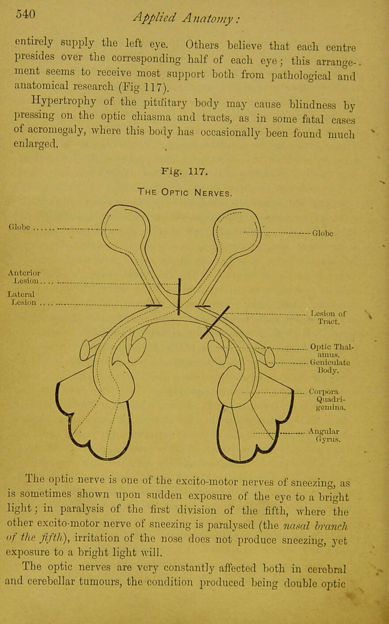 entirely supply the left eye. Otliers believe that each centre presides over the corresponding half of each eye; this arrange-. ment seems to receive most support both from pathological and anatomical research (Fig 117). Hypertrophy of the pituitary body may cause blindness by pressing on the optic chiasma and tracts, as in some fatal cases of acromegaly, where this body has occasionally been found much enlarged. Fig. 117. The Optic Nerves. -Globe r.esinii of Tiiict. Optic Th.il- .anms. Gouiculato Uody. U- .1.-. C'l.rpoin Qiiadri- gemiiiu. Angular Gyms. The optic nerve is one of the excito-motor nerves of sneezing, as is sometimes shown upon sudden exposure of the eye to a bright light; in paralysis of the first division of the fifth, where the other excito-motor nerve of sneezing is paralysed (the nasal hmncli of the Jij'th), irritation of the nose does not produce sneezing, yet exposure to a bright light -will. The optic nerves are very constantly affected both in cerebral and cerebellar tumours, the condition produced being double optic