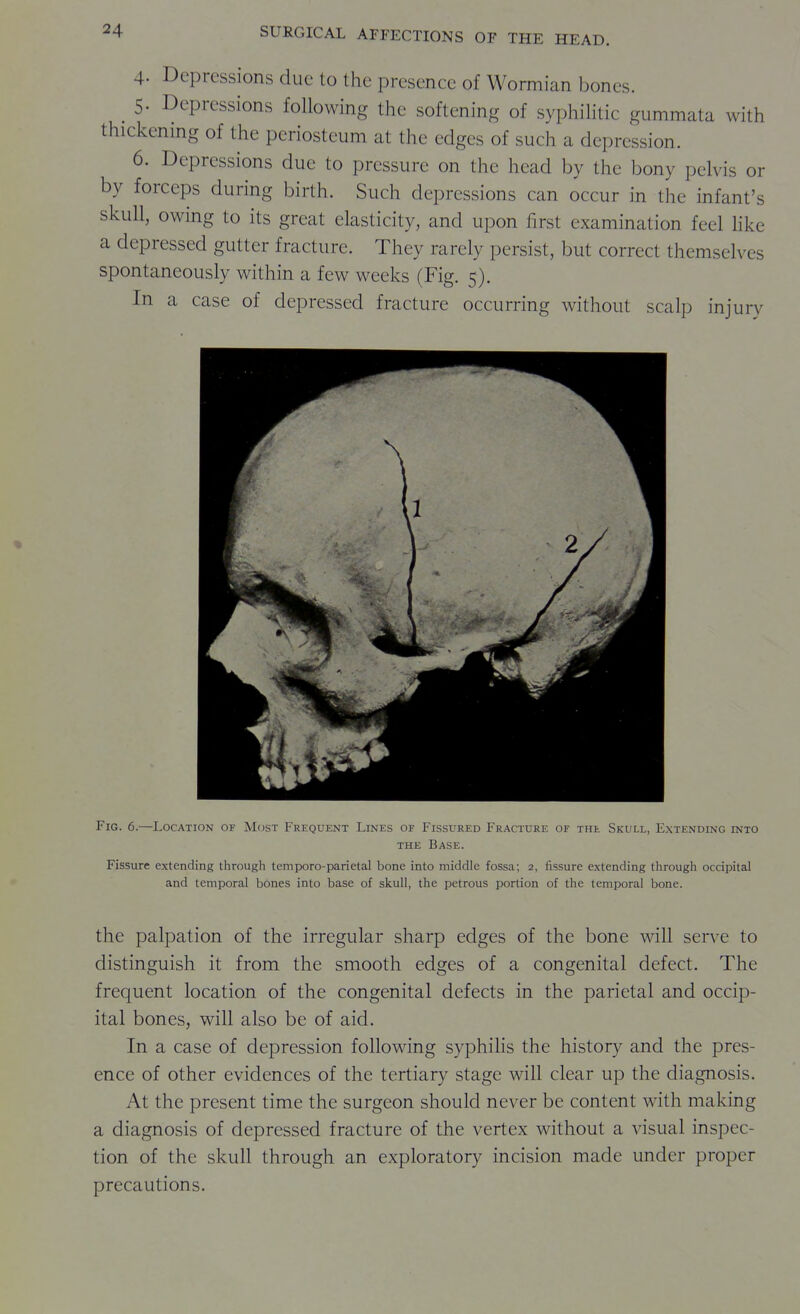 4. Depressions due to the presence of Wormian bones. ^ 5. Depressions following the softening of syphilitic gummata with thickening of the periosteum at the edges of such a depression. 6. Depressions due to pressure on the head by the bony pelvis or by forceps during birth. Such depressions can occur in the infant's skull, owing to its great elasticity, and upon first examination feel hke a depressed gutter fracture. They rarely persist, but correct themselves spontaneously within a few weeks (Fig. 5). In a case of depressed fracture occurring without scalp injury Fig. 6.—Location of Most Frequent Lines of Fissured Fracture of the Skull, Extending into THE Base. Fissure extending through temporo-parietal bone into middle fossa; 2, fissure extending through occipital and temporal bones into base of skull, the petrous portion of the temporal bone. the palpation of the irregular sharp edges of the bone will serve to distinguish it from the smooth edges of a congenital defect. The frequent location of the congenital defects in the parietal and occip- ital bones, will also be of aid. In a case of depression following syphihs the history and the pres- ence of other evidences of the tertiary stage will clear up the diagnosis. At the present time the surgeon should never be content with making a diagnosis of depressed fracture of the vertex without a visual inspec- tion of the skull through an exploratory incision made under proper precautions.