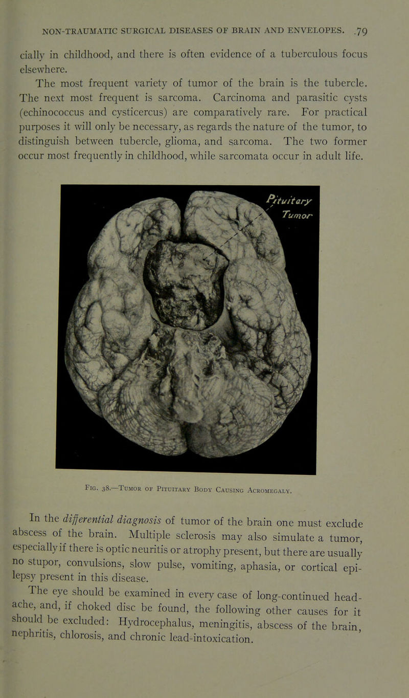 daily in childhood, and there is often evidence of a tuberculous focus elsewhere. The most frequent variety of tumor of the brain is the tubercle. The next most frequent is sarcoma. Carcinoma and parasitic cysts (echinococcus and cysticercus) are comparatively rare. For practical purposes it will only be necessary, as regards the nature of the tumor, to distinguish between tubercle, glioma, and sarcoma. The two former occur most frequently in childhood, while sarcomata occur in adult Hfe. Fig. 38—Tumor of Pituitary Body Causing Acromegaly. In the differential diagnosis of tumor of the brain one must exclude abscess of the brain. Multiple sclerosis may also simulate a tumor, especially if there is optic neuritis or atrophy present, but there are usually no stupor, convulsions, slow pulse, vomiting, aphasia, or cortical epi- lepsy present in this disease. The eye should be examined in every case of long-continued head- ache, and, if choked disc be found, the following other causes for it should be excluded: Hydrocephalus, meningitis, abscess of the brain nephritis, chlorosis, and chronic lead-intoxication.