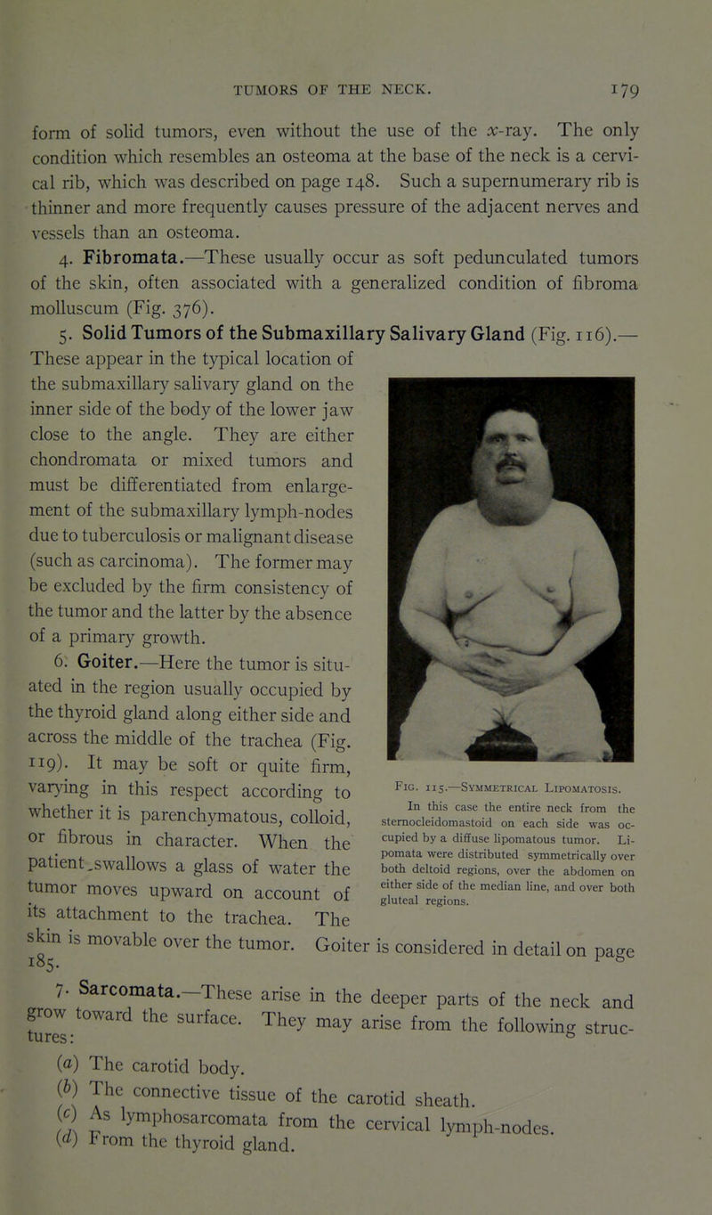 form of solid tumors, even without the use of the ^-ray. The only- condition which resembles an osteoma at the base of the neck is a cervi- cal rib, which was described on page 148. Such a supernumerary rib is thinner and more frequently causes pressure of the adjacent nerves and vessels than an osteoma. 4. Fibromata.—These usually occur as soft pedunculated tumors of the skin, often associated with a generahzed condition of fibroma moUuscum (Fig. 376). 5. Solid Tumors of the Submaxillary Salivary Gland (Fig. 116).— These appear in the typical location of the submaxillary saHvary gland on the inner side of the body of the lower jaw close to the angle. They are either chondromata or mixed tumors and must be differentiated from enlarge- ment of the submaxillary lymph-nodes due to tuberculosis or mahgnant disease (such as carcinoma). The former may be excluded by the firm consistency of the tumor and the latter by the absence of a primary growth. 6. Goiter.—Here the tumor is situ- ated in the region usually occupied by the thyroid gland along either side and across the middle of the trachea (Fig. 119). It may be soft or quite firm, varying in this respect according to whether it is parenchymatous, colloid, or fibrous in character. When the patient,swallows a glass of water the tumor moves upward on account of its attachment to the trachea. The skin is movable over the tumor. Goiter is considered in detail on page 7. Sarcomata.-These arise in the deeper parts of the neck and grow toward the surface. They may arise from the following struc- (a) The carotid body. (b) The connective tissue of the carotid sheath. fl t' ^^'^^^^^^^^^^ta from the cervical lymph-nodes. [d) From the thyroid gland. Fig. 115.—Symmetrical Lipomatosis. In this case the entire neck from the sternocleidomastoid on each side was oc- cupied by a diffuse lipomatous tumor. Li- pomata were distributed symmetrically over both deltoid regions, over the abdomen on either side of the median line, and over both gluteal regions.