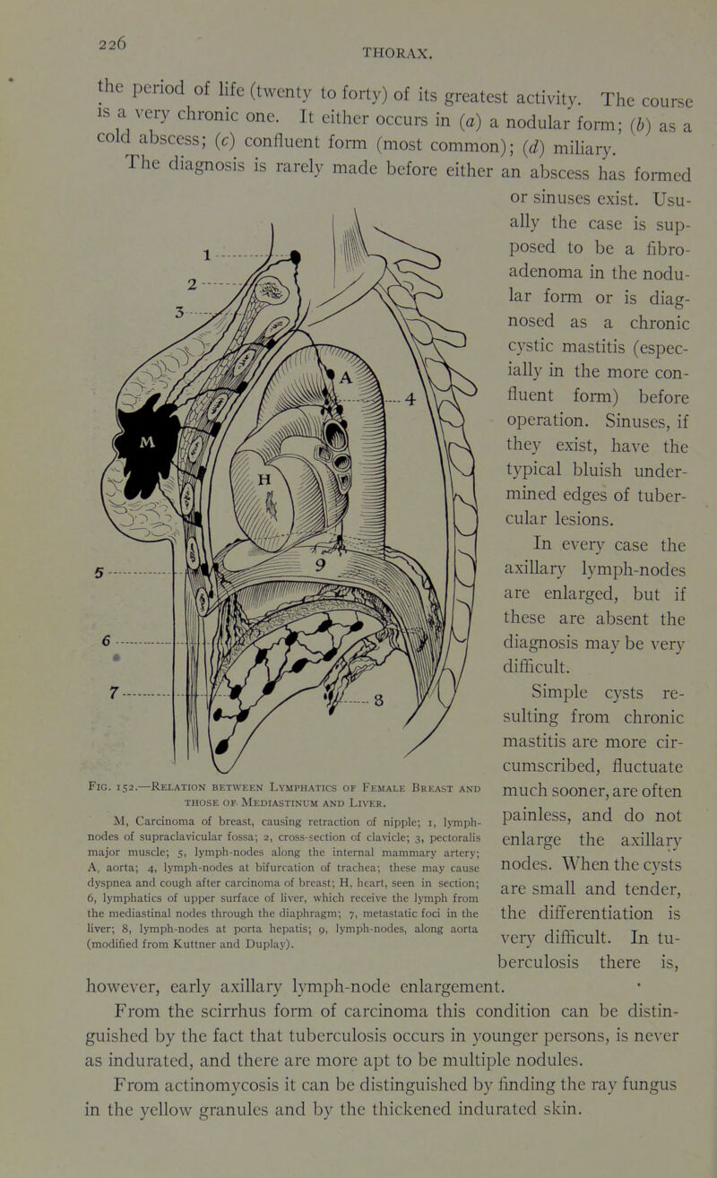 THORAX. the period of life (twenty to forty) of its greatest activity. The course IS a very chronic one. It either occurs in (a) a nodular form; (b) as a cold abscess; (c) confluent form (most common); (d) miliary. The diagnosis is rarely made before either an abscess has formed or sinuses exist. Usu- ally the case is sup- posed to be a fibro- adenoma in the nodu- lar form or is diag- nosed as a chronic cystic mastitis (espec- ially in the more con- fluent form) before operation. Sinuses, if they exist, have the typical bluish under- mined edges of tuber- cular lesions. In every case the axillary lymph-nodes are enlarged, but if these are absent the diagnosis may be very difficult. Simple cysts re- sulting from chronic mastitis are more cir- cumscribed, fluctuate much sooner, are often painless, and do not enlarge the axillary nodes. When the cysts are small and tender, the differentiation is very difficult. In tu- berculosis there is, how^ever, early axillary lymph-node enlargement. From the scirrhus form of carcinoma this condition can be distin- guished by the fact that tuberculosis occurs in younger persons, is never as indurated, and there are more apt to be multiple nodules. From actinomycosis it can be distinguished by finding the ray fungus in the yellow granules and by the thickened indurated skin. Fig. 152.—Relation between Lymphatics of Female Breast and THOSE OF Mediastinum and Liver. M, Carcinoma of breast, causing retraction of nipple; i, lymph- nodes of supraclavicular fossa; 2, cross-section of clavicle; 3, pectoralis major muscle; 5, lymph-nodes along the internal mammary artery; A, aorta; 4, lymph-nodes at bifurcation of trachea; these may cause dyspnea and cough after carcinoma of breast; H, heart, seen in section; 6, lymphatics of upper surface of liver, which receive the lymph from the mediastinal nodes through the diaphragm; 7, metastatic foci in the liver; 8, lymph-nodes at porta hepatis; 9, lymph-nodes, along aorta (modified from Kuttner and Duplay).