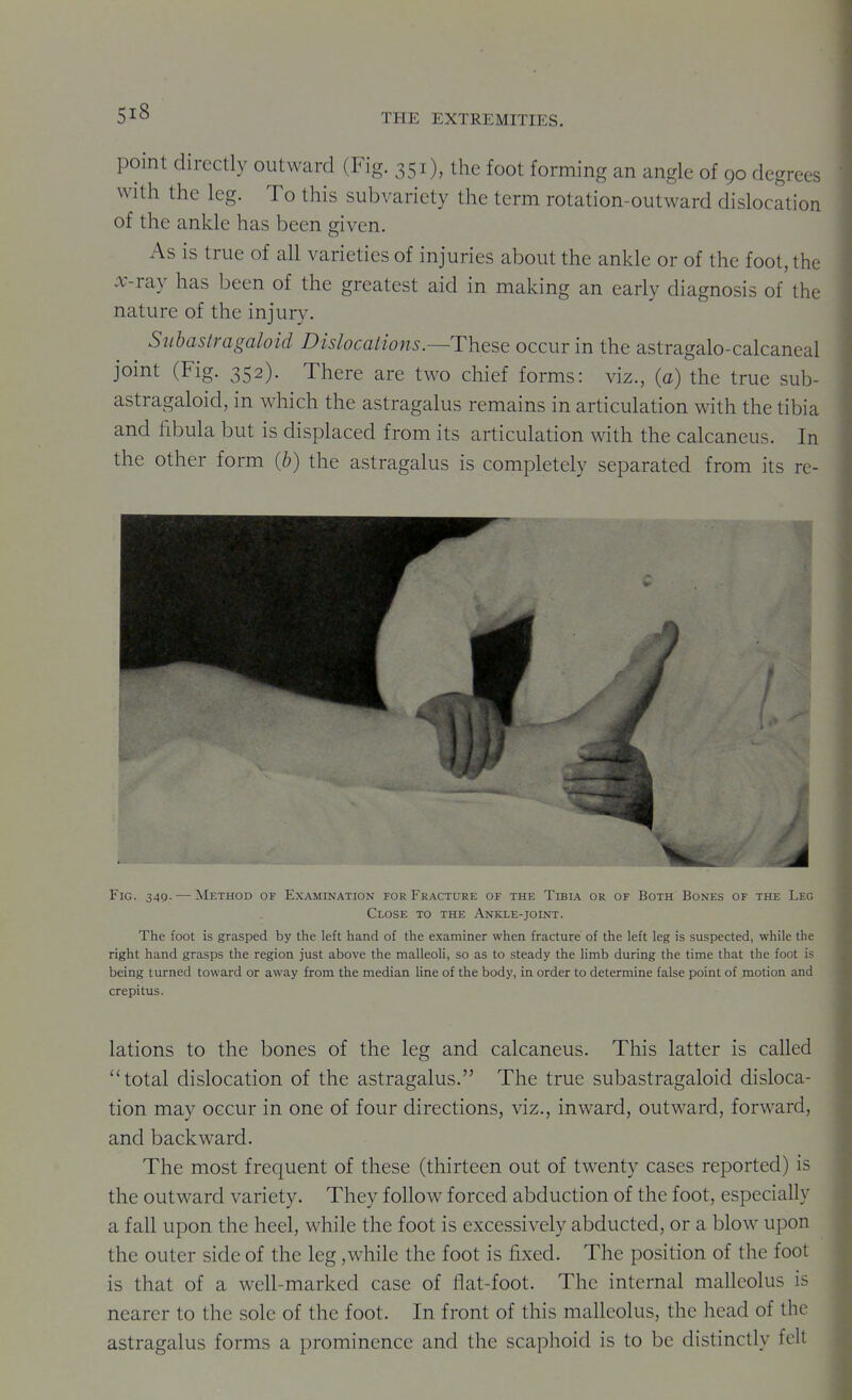 point directly outward (Fig. 351), the foot forming an angle of 90 degrees with the leg. To this subvariety the term rotation-outward dislocation of the ankle has been given. As is true of all varieties of injuries about the ankle or of the foot, the :v-ray has been of the greatest aid in making an early diagnosis of the nature of the injury. Suhastragaloid Dislocations.—These occur in the astragalo-calcaneal joint (Fig. 352). There are two chief forms: viz., (a) the true suh- astragaloid, in which the astragalus remains in articulation with the tibia and fibula but is displaced from its articulation with the calcaneus. In the other form (b) the astragalus is completely separated from its re- Fig. 349. — Method of Examination for Fracture of the Tibia or of Both Bones of the Leg Close to the Ankle-joint. The foot is grasped by the left hand of the examiner when fracture of the left leg is suspected, while the right hand grasps the region just above the malleoli, so as to steady the limb during the time that the foot is being turned toward or away from the median line of the body, in order to determine false point of motion and crepitus. lations to the bones of the leg and calcaneus. This latter is called total dislocation of the astragalus. The true suhastragaloid disloca- tion may occur in one of four directions, viz., inward, outward, forward, and backward. The most frequent of these (tliirteen out of twenty cases reported) is the outward variety. They follow forced abduction of the foot, especially a fall upon the heel, while the foot is excessively abducted, or a blow upon the outer side of the leg,while the foot is fixed. The position of the foot is that of a well-marked case of flat-foot. The internal malleolus is nearer to the sole of the foot. In front of this malleolus, the head of the astragalus forms a prominence and the scaphoid is to be distinctly felt