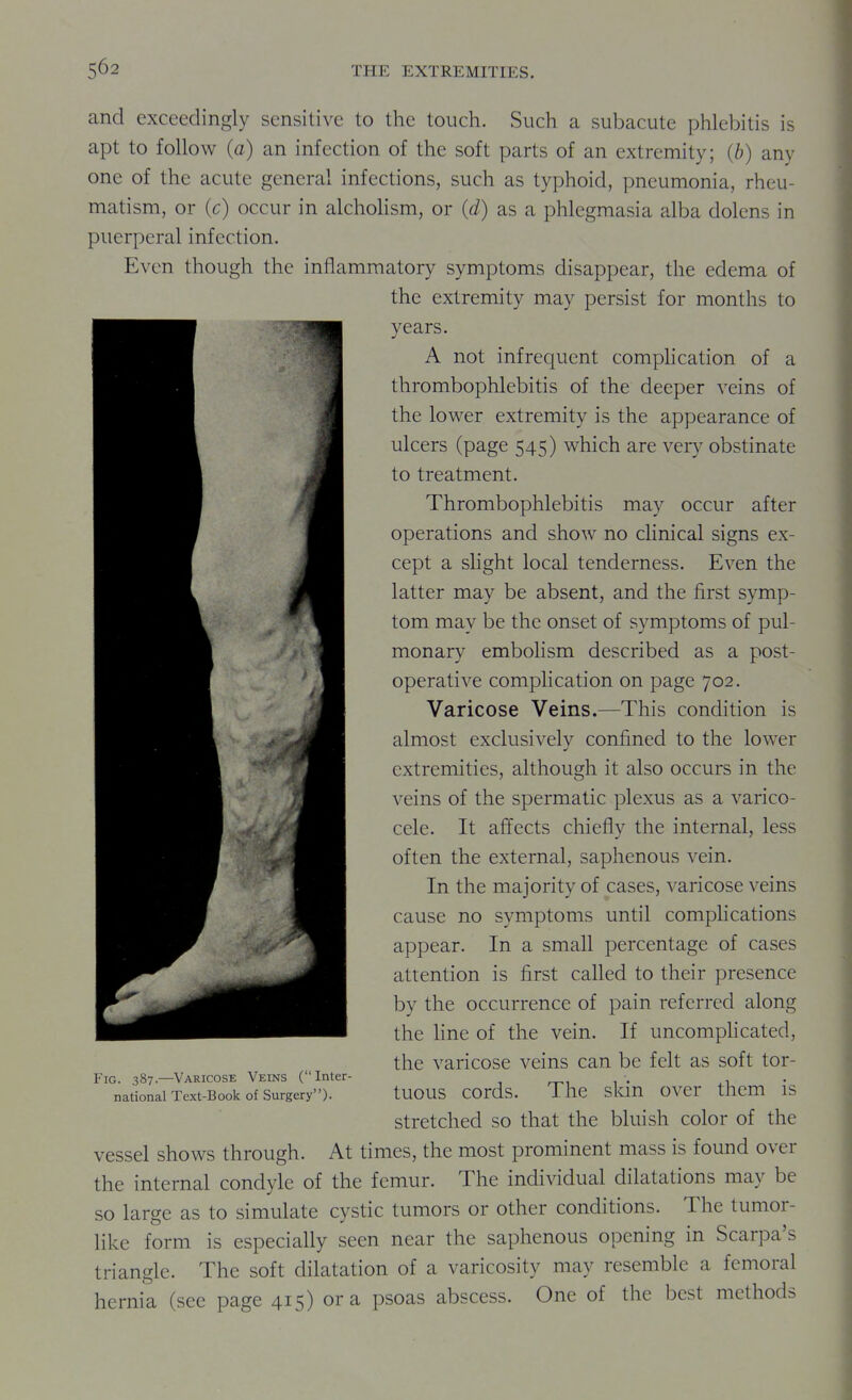 and exceedingly sensitive to the touch. Such a subacute phlebitis is apt to follow (a) an infection of the soft parts of an extremity; {b) any one of the acute general infections, such as typhoid, pneumonia, rheu- matism, or (c) occur in alchoHsm, or {d) as a phlegmasia alba dolens in puerperal infection. Even though the inflammatory symptoms disappear, the edema of the extremity may persist for months to years. A not infrequent comphcation of a thrombophlebitis of the deeper veins of the lower extremity is the appearance of ulcers (page 545) which are very obstinate to treatment. Thrombophlebitis may occur after operations and show no clinical signs ex- cept a slight local tenderness. Even the latter may be absent, and the first symp- tom may be the onset of symptoms of pul- monary embolism described as a post- operative complication on page 702. Varicose Veins.—This condition is almost exclusivelv confined to the lower extremities, although it also occurs in the veins of the spermatic plexus as a varico- cele. It affects chiefly the internal, less often the external, saphenous vein. In the majority of cases, varicose veins cause no symptoms until complications appear. In a small percentage of cases attention is first called to their presence by the occurrence of pain referred along the Hne of the vein. If uncomphcated, the varicose veins can be felt as soft tor- FiG. 387—Varicose Veins (Inter- . , national Text-Book of Surgery). tUOUS COrdS. I hC SlaU OVCr t^Cm IS stretched so that the bluish color of the vessel shows through. At times, the most prominent mass is found over the internal condyle of the femur. The individual dilatations may be so large as to simulate cystic tumors or other conditions. The tumor- like form is especially seen near the saphenous opening in Scarpa's triangle. The soft dilatation of a varicosity may resemble a femoral hernia (see page 415) or a psoas abscess. One of the best methods