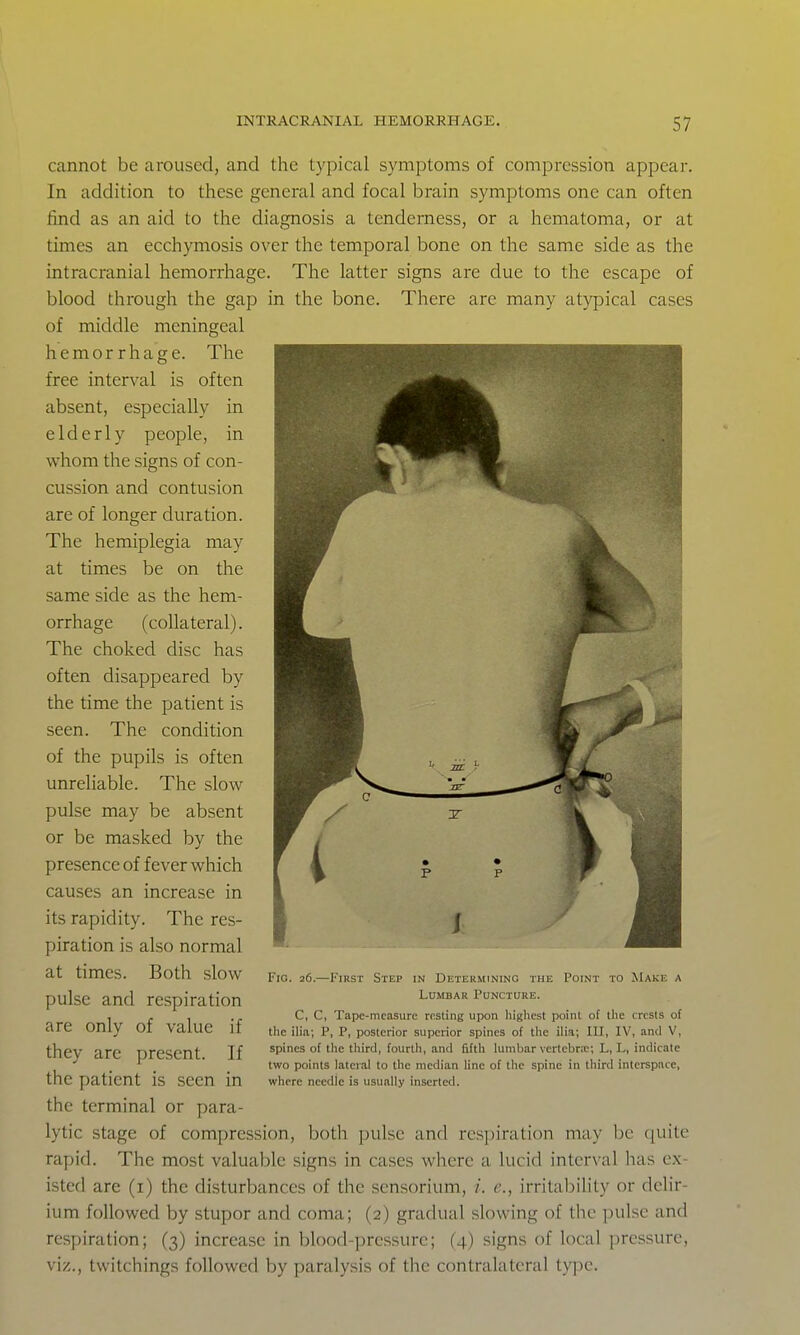 cannot be aroused, and the typical symptoms of compression appear. In addition to these general and focal brain symptoms one can often find as an aid to the diagnosis a tenderness, or a hematoma, or at times an ecchymosis over the temporal bone on the same side as the intracranial hemorrhage. The latter signs are due to the escape of blood through the gap in the bone. There are many atypical cases of middle meningeal hemorrhage. The free interval is often absent, especially in elderly people, in whom the signs of con- cussion and contusion are of longer duration. The hemiplegia may at times be on the same side as the hem- orrhage (collateral). The choked disc has often disappeared by the time the patient is seen. The condition of the pupils is often unreliable. The slow pulse may be absent or be masked by the presence of fever which causes an increase in its rapidity. The res- piration is also normal at times. Both slow pulse and respiration are only of value if they arc present. If the patient is seen in the terminal or para- lytic stage of compression, both pulse and respiration may be quite rapid. The most valuable signs in cases where a lucid interval has ex- isted are (i) the disturbances of the sensorium, /. c, irritability or delir- ium followed by stupor and coma; (2) gradual slowing of the pulse and respiration; (3) increase in blood-pressure; (4) signs of local pressure, viz., twitchings followed by f)aralysis of the contralateral type. Fig. 26.—First Step in Determining the Point to Make a Lumbar Puncture. C, C, Tapc-nicasurc rcsling upon highest point of the crests of the ilia; P, P, posterior superior spines of tlic ilia; HI, IV, and V, spines of the third, fourth, and lifth lumbar vertebrtc; L, L, indicate two points lateral to the median line of the spine in third interspace, where needle is usually inserted.