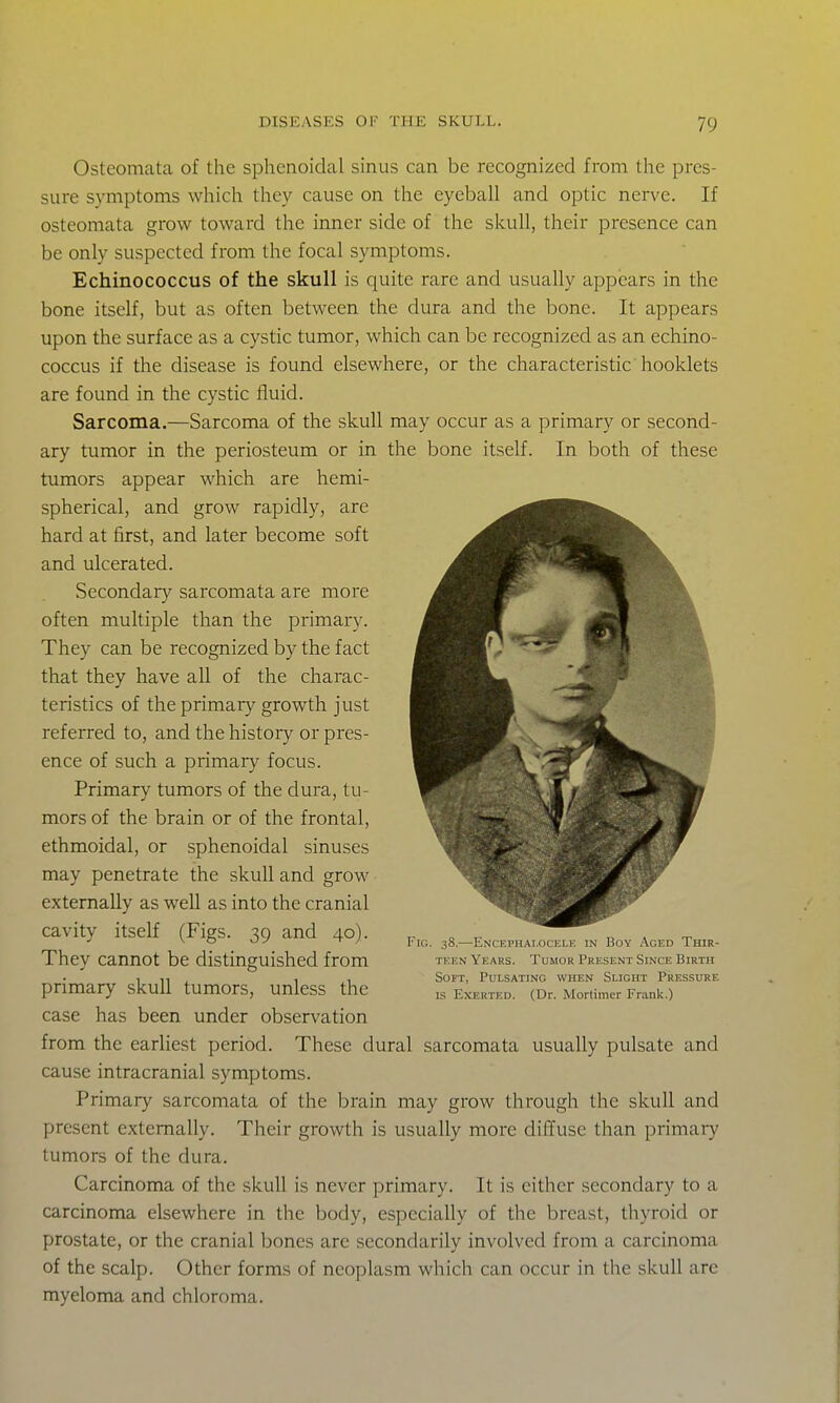 Osteomata of the sphenoidal sinus can be recognized from the pres- sure symptoms which they cause on the eyeball and optic nerve. If osteomata grow toward the inner side of the skull, their presence can be only suspected from the focal symptoms. Echinococcus of the skull is quite rare and usually appears in the bone itself, but as often between the dura and the bone. It appears upon the surface as a cystic tumor, which can be recognized as an echino- coccus if the disease is found elsewhere, or the characteristic booklets are found in the cystic fluid. Sarcoma.—Sarcoma of the skull may occur as a primary or second- ary tumor in the periosteum or in the bone itself. In both of these tumors appear which are hemi- spherical, and grow rapidly, are hard at first, and later become soft and ulcerated. Secondary sarcomata are more often multiple than the primary. They can be recognized by the fact that they have all of the charac- teristics of the primary growth just referred to, and the histoiy or pres- ence of such a primary focus. Primary tumors of the dura, tu- mors of the brain or of the frontal, ethmoidal, or sphenoidal sinuses may penetrate the skull and grow externally as well as into the cranial cavity itself (Figs. 39 and 40). They cannot be distinguished from primary skull tumors, unless the case has been under observation from the earliest period. These dural sarcomata usually pulsate and cause intracranial symptoms. Primary sarcomata of the brain may grow through the skull and present externally. Their growth is usually more diffuse than primary tumors of the dura. Carcinoma of the skull is never primary. It is cither secondary to a carcinoma elsewhere in the body, especially of the breast, thyroid or prostate, or the cranial bones are secondarily involved from a carcinoma of the scalp. Other forms of neoplasm which can occur in the skull are myeloma and chloroma. Fig. 38.—Encki'iiai.ocli.k in lioy Aged Thir- teen Years. Tumor Present Since Birth Soft, Pulsating when Slight Pressure IS Exerted. (Dr. Mortimer Frank.)