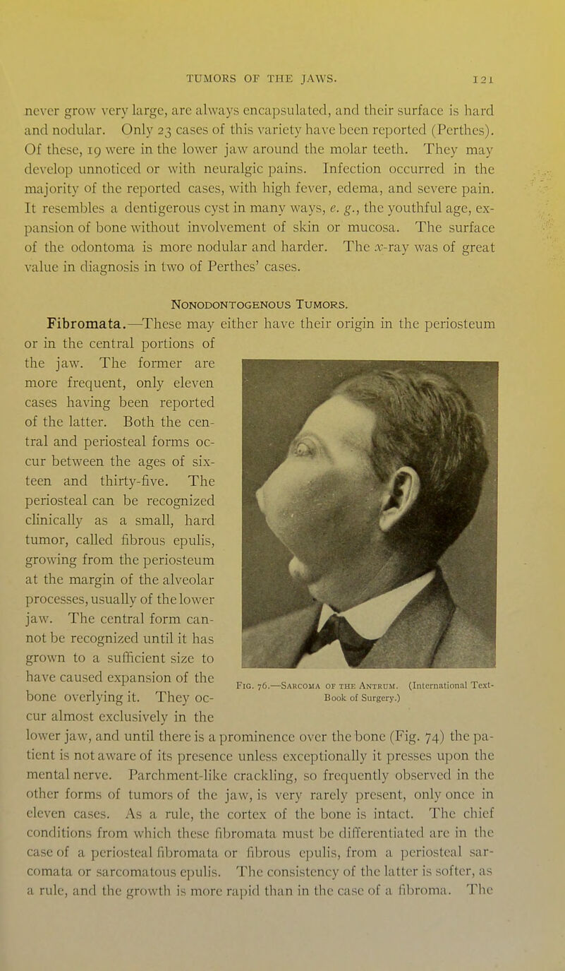 nc\'er grow \'cry large, arc always encapsulated, and their surface is hard and nodular. Only 23 cases of this variety have been reported (Perthes). Of these, 19 were in the lower jaw around the molar teeth. They may develop unnoticed or with neuralgic pains. Infection occurred in the majority of the reported cases, with high fever, edema, and severe pain. It resembles a dentigerous cyst in many ways, e. g., the youthful age, ex- pansion of bone without involvement of skin or mucosa. The surface of the odontoma is more nodular and harder. The .r-ray was of great value in diagnosis in two of Perthes' cases. NONODONTOGENOUS TUMORS. Fibromata.—^These may either have their origin in the periosteum or in the central portions of the jaw. The former are more frequent, only eleven cases having been reported of the latter. Both the cen- tral and periosteal forms oc- cur between the ages of six- teen and thirty-five. The periosteal can be recognized clinically as a small, hard tumor, called fibrous epulis, growing from the periosteum at the margin of the alveolar processes, usually of the lower jaw. The central form can- not be recognized until it has grown to a sufficient size to have caused expansion of the bone overlying it. They oc- cur almost exclusively in the lower jaw, and until there is a prominence over the bone (Fig. 74) the pa- tient is not aware of its presence unless exceptionally it presses upon the mental nerve. Parchment-like crackling, so frequently observed in the other forms of tumors of the jaw, is very rarely present, only once in eleven cases. As a rule, the cortex of the bone is intact. The chief conditions from which these fibromata must be differentiated arc in the case of a periosteal fibromata or fibrous epulis, from a periosteal sar- comata or sarcomatous epulis. The consistency of the latter is softer, as a rule, and the growth is more ra]iid than in the case of a fibroma. The Fig. 76.—Sarcoma of the Antrum. (International Tc.xt- Book of Surgery.)