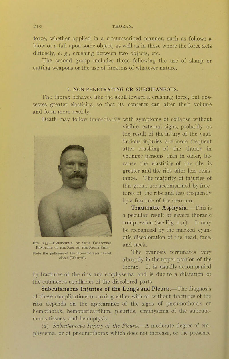 force, whether appUed in a circumscribed manner, such as follows a blow or a fall upon some object, as well as in those where the force acts diffusely, e. g., crushing between two objects, etc. The second group includes those following the use of sharp or cutting weapons or the use of firearms of whatever nature. I. NON-PENETRATING OR SUBCUTANEOUS. The thorax behaves like the skull toward a crushing force, but pos- sesses greater elasticity, so that its contents can alter their volume and form more readily. Death may follow immediately with symptoms of collapse without visible external signs, probably as the result of the injury of the vagi. Serious injuries are more frequent after crushing of the thorax in yoimger persons than in older, be- cause the elasticity of the ribs is greater and the ribs offer less resis- tance. The majority of injuries of this group are accompanied by frac- tures of the ribs and less frequently by a fracture of the sternum. Traumatic Asphyxia.—This is a peculiar result of severe thoracic compression (see Fig. 141). It may be recognized by the marked cyan- otic discoloration of the head, face, and neck. The cyanosis terminates very abruptly in the upper portion of the thorax. It is usually accompanied by fractures of the ribs and emphysema, and is due to a dilatation of the cutaneous capillaries of the discolored parts. Subcutaneous Injuries of the Lungs and Pleura.—The diagnosis of these complications occurring cither with or without fractures of the ribs depends on the appearance of the signs of pneumothorax or hemothorax, hemopcricardium, pleuritis, emphysema of the subcuta- neous tissues, and hemoptysis. (a) Subcutaneous Injury of the Pleura.—A moderate degree of em- physema, or of pneumothorax which docs not increase, or the presence Fig. 143.—EMrHYSEMA of Skin Following Fracture of the Ribs on the Right Side. Note the puQiness of the face—the eyes almost closed (Warren').