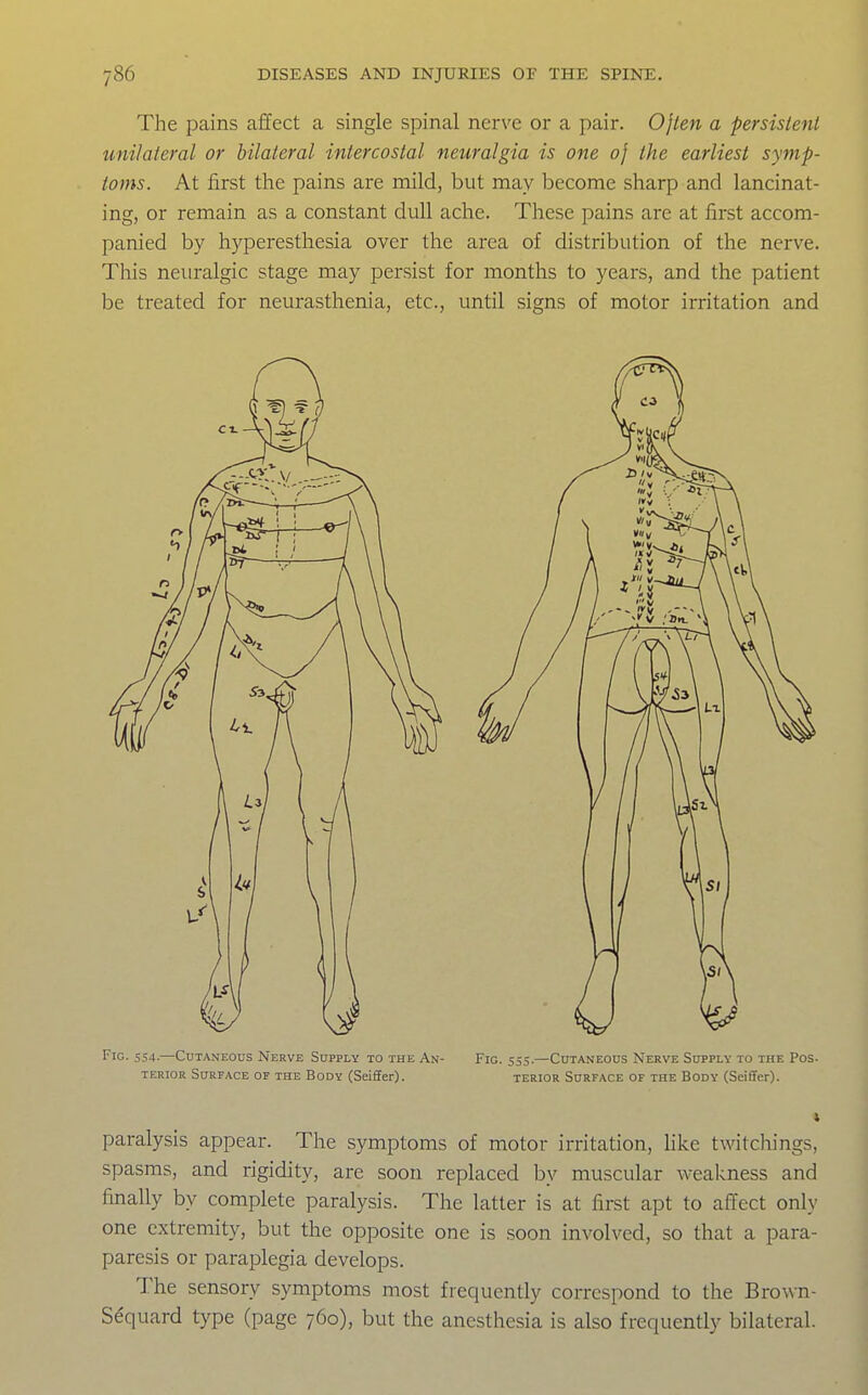 The pains affect a single spinal nerve or a pair. Ojlen a persistent unilateral or bilateral intercostal neuralgia is one oj the earliest symp- toms. At first the pains are mild, but may become sharp and lancinat- ing, or remain as a constant dull ache. These pains are at first accom- panied by hyperesthesia over the area of distribution of the nerve. This neuralgic stage may persist for months to years, and the patient be treated for neurasthenia, etc., until signs of motor irritation and Fig. 554.—Cutaneous Nerve Supply to the An- Fig. 555.—Cutaneous Nerve Supply to the Pos- terior Surface of the Body (Seiffer). terior Surface of the Body (Seiffer). paralysis appear. The symptoms of motor irritation, hke twitchings, spasms, and rigidity, are soon replaced by muscular weakness and finally by complete paralysis. The latter is at first apt to affect only one extremity, but the opposite one is soon involved, so that a para- paresis or paraplegia develops. The sensory symptoms most frequently correspond to the Brown- Sequard type (page 760), but the anesthesia is also frequently bilateral.