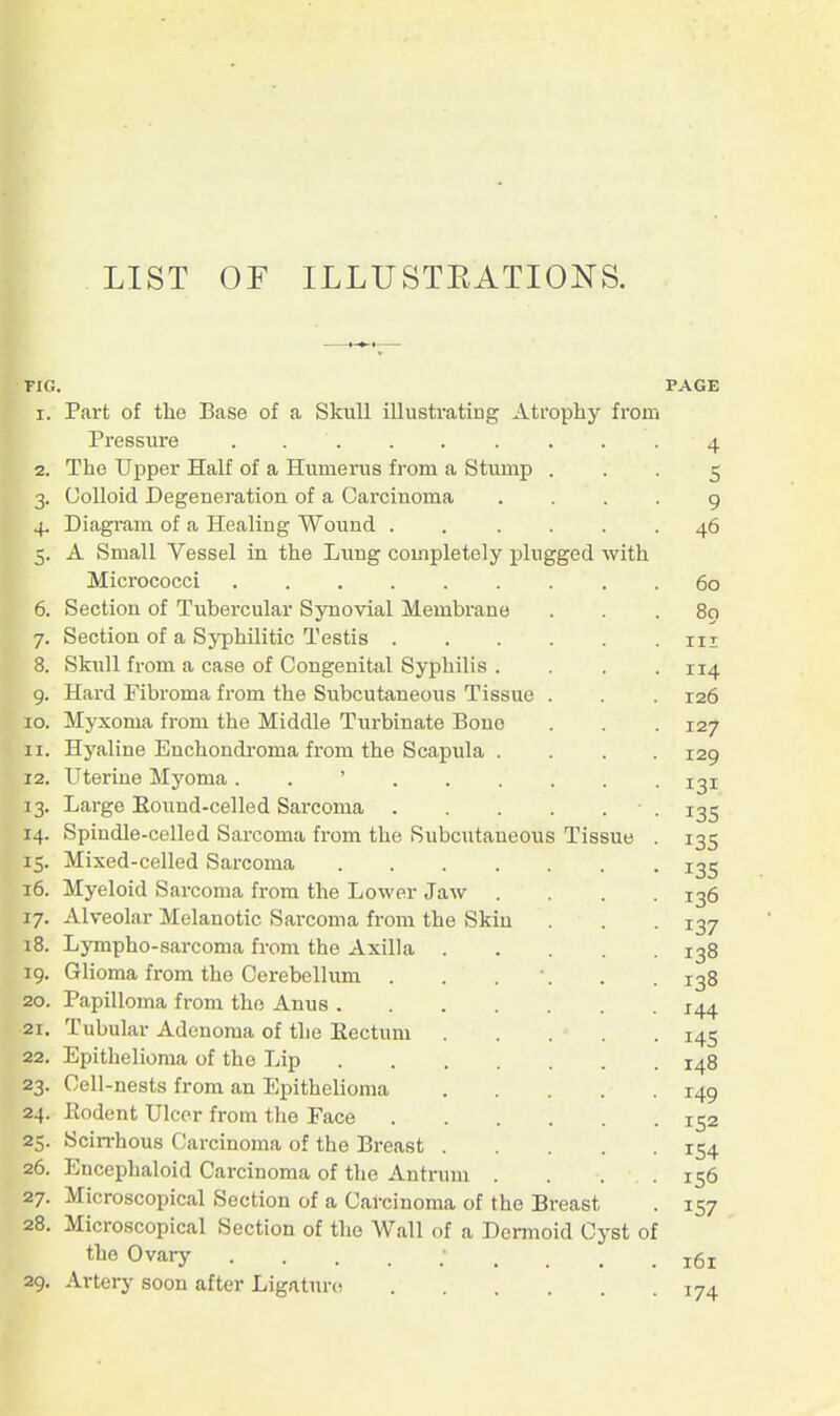 LIST or ILLUSTEATIONS. FIG. PAGE 1. Part of the Base of a Skull illusti-ating Atrophy from Pressure . 4 2. The Upper Half of a Humerus from a Stump . . • 5 3. Colloid Degeneration of a Carcinoma .... 9 4. Diagi-am of a Healing Wound . . .... 46 5. A Small Vessel in the Lung completely plugged with Micrococci 60 6. Section of Tubercular Synovial Membrane ... 80 7. Section of a Syphilitic Testis in 8. Skull from a case of Congenital Syphilis . . . .114 9. Hard Fibroma from the Subcutaneous Tissue . . . 126 10. Myxoma from the Middle Tiirbinate Bono . . . 127 11. Hyaline Enchondroma from the Scapula .... 129 12. Uterine Myoma 131 13. Large Eound-celled Sarcoma 135 14. Spindle-celled Sarcoma from the Subcutaneous Tissue . 135 15. Mixed-celled Sarcoma 135 16. Myeloid Sarcoma from the Lower Jaw .... 136 17. Alveolar Melanotic Sarcoma from the Skiu . . 137 18. Lympho-sarcoma from the Axilla 138 19. Glioma fi-om the Cerebellum . . . •. . .138 20. Papilloma from the Anus 144 21. Tubular Adenoma of the Eectum 145 22. Epithelioma of the Lip 148 23. Cell-nests from an Epithelioma 149 24. Eodent Ulcer from the Face 152 25. Scin-hous Carcinoma of the Breast 154 26. Encephaloid Carcinoma of the Antrum . . . .156 27. Microscopical Section of a Carcinoma of the Breast . 157 28. Microscopical Section of the Wall of a Dermoid Cyst of the Ovary 161 29. Artery soon after Ligntnro 174