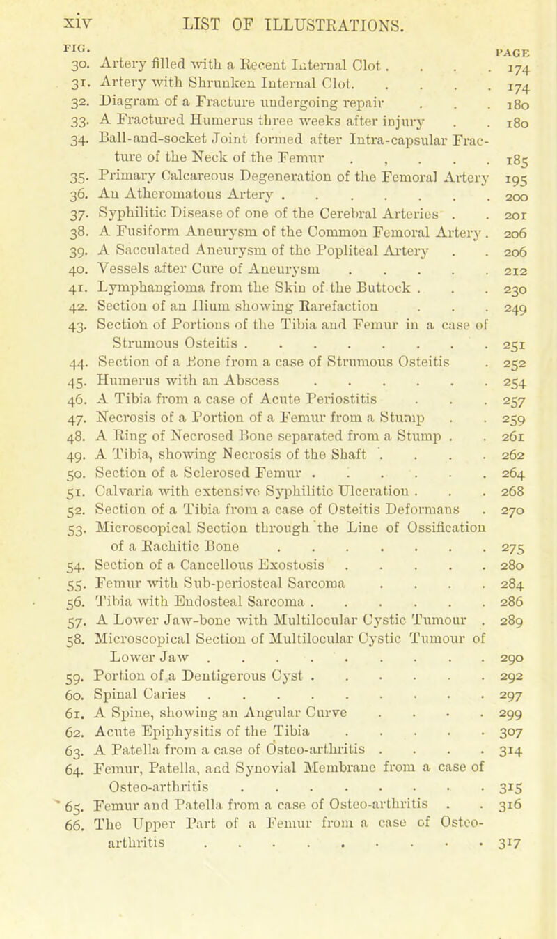 I'AGK 30. Artery filled with a Eecent Iiiternal Clot. . . .174 31. Arterj' with Shrunken Internal Clot 174 32. Diagram of a Fracture undergoing repair . . . 180 33. A Tractm-ed Humerus three weeks after injury . . 180 34. Ball-and-socket Joint formed after Intra-capsular Frac- ture of the Neck of the Femur . , . . . 185 35. Primary Calcareous Degeneration of the Femoral Artery 195 36. Au Athei'omatous Artery . 200 37. Syphilitic Disease of one of the Cerebral Arteries . . 201 38. A Fusiform Aneurysm of the Common Femoral Artery . 206 39. A Sacculated Aneurysm of the Popliteal Artery . . 206 40. Vessels after Cure of Aneurysm 212 41. Lymphangioma from the Skin of the Buttock . . . 230 42. Section of an Jlium showing Earefaction . . . 249 43. Section of Portions of the Tibia and Femur in a case of Strumous Osteitis 251 44. Section of a Bone from a case of Strumous Osteitis . 252 45. Humerus with an Abscess 254 46. A Tibia from a case of Acute Periostitis . . . 257 47. Necrosis of a Portion of a Femur from a Stump . . 259 48. A Eing of Necrosed Bone sepai'ated fi-om a Stump . . 261 49. A Tibia, showing Necrosis of the Shaft .... 262 50. Section of a Sclerosed Femur 264 51. Calvaria with extensive Syphilitic Ulceration . . . 268 32. Section of a Tibia from a case of Osteitis Deformans . 270 53. Microscopical Section through the Line of Ossification of a Eachitic Bone ....... 275 54. Section of a Cancellous Exostosis 280 55. Femur with Sub-periosteal Saixoma .... 284 56. Tibia with Endosteal Sarcoma ...... 286 57. A Lower Jaw-bone Avith Multilocular Cystic Tumour . 289 58. Microscopical Section of Multilocular Cystic Tumour of Lower Jaw ......... 290 59. Portion of a Dentigerous Cj'st 292 60. Spinal Caries 297 61. A Spine, showing an Angular Curve .... 299 62. Acute Epiphysitis of the Tibia 307 63. A Patella from a case of Osteo-arthritis .... 314 64. Femur, Patella, and Sj^novial Membrane from a case of Osteo-arthritis 315 ' 65. Femur and Patella from a case of Osteo-arthritis . . 316 66. The Upper Part of a Femur from a case of Osteo- arthritis 317