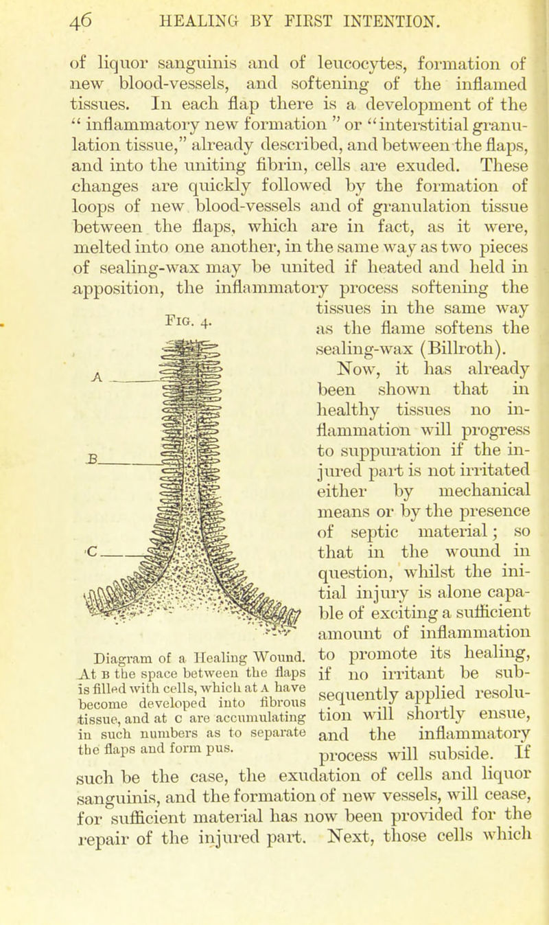 Fig. of liquor sanguinis and of leucocytes, formation of new blood-vessels, and softening of the inflamed tissues. In each flap there is a development of the  inflammatory new formation  or  interstitial granu- lation tissue, already described, and between the flaps, and into the uniting fibiin, cells are exuded. These changes are quickly followed by the formation of loops of new blood-vessels and of granulation tissue between the flaps, which are in fact, as it were, melted into one another, in the same way as two pieces of sealing-wax may be united if heated and held in apposition, the inflammatory process softening the tissues in the same way as the flame softens the sealing-wax (Billroth). Now, it has already been shown that in healthy tissues no in- flammation will progress to suppui'ation if the in- jured pait is not irritated either by mechanical means or by the presence of septic material • so that in the wound in question, whilst the ini- tial injury is alone capa- ble of exciting a suflicient amount of inflammation Diagram of a Healing Wound, to promote its healing, At B the space between the flaps if no irritant be sub- isfill^dwithcells whichatA have ..gq^^ently applied resolu- become developed into librous .1 J tissue, and at c are accumulating tion will shortly ensue, in such numbers as to separate ^nd the inflammatory the flaps and form pus. process wUl subside. If such be the case, the exudation of cells and liquor sangviinis, and the formation of new vessels, will cease, for sufficient material has now been provided for the repair of the injured part. Next, those cells which